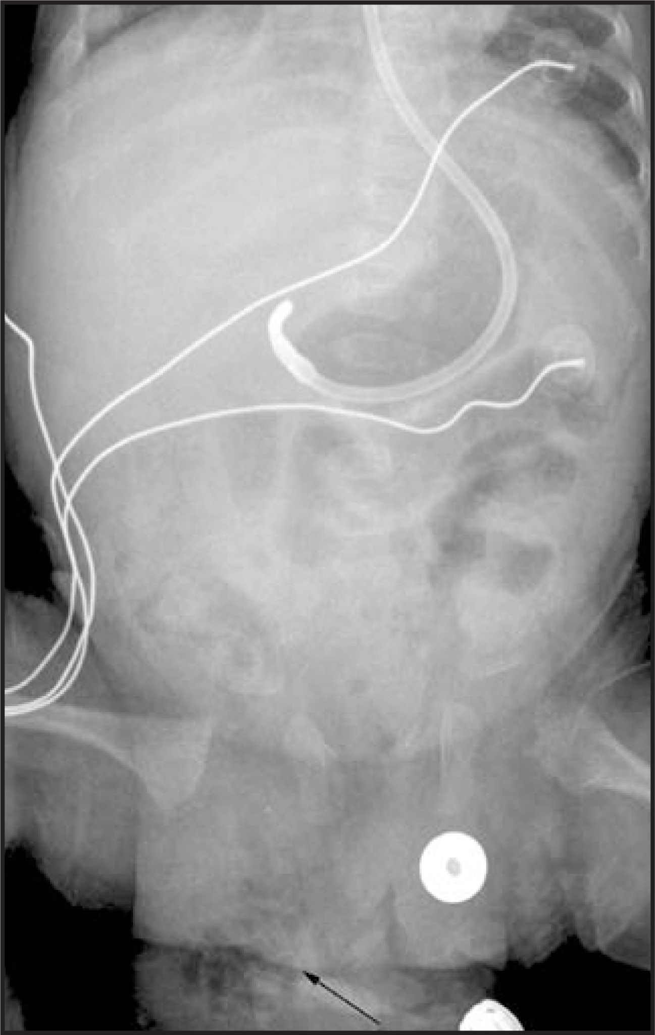 FIGURE 17.