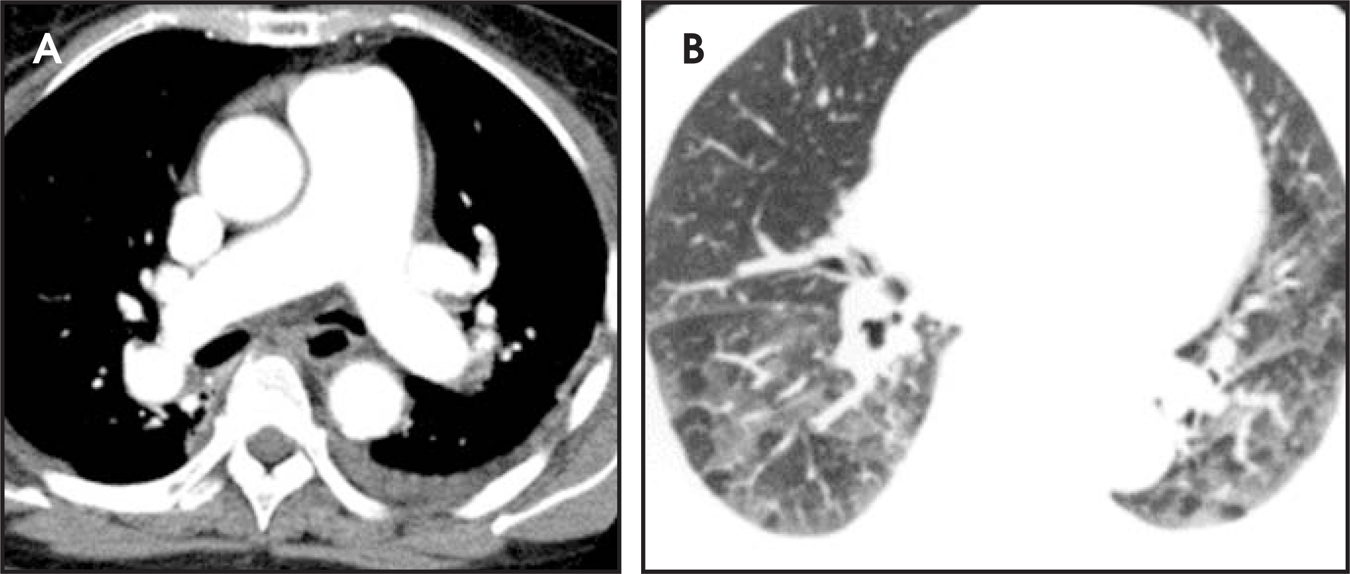 FIGURE 10.