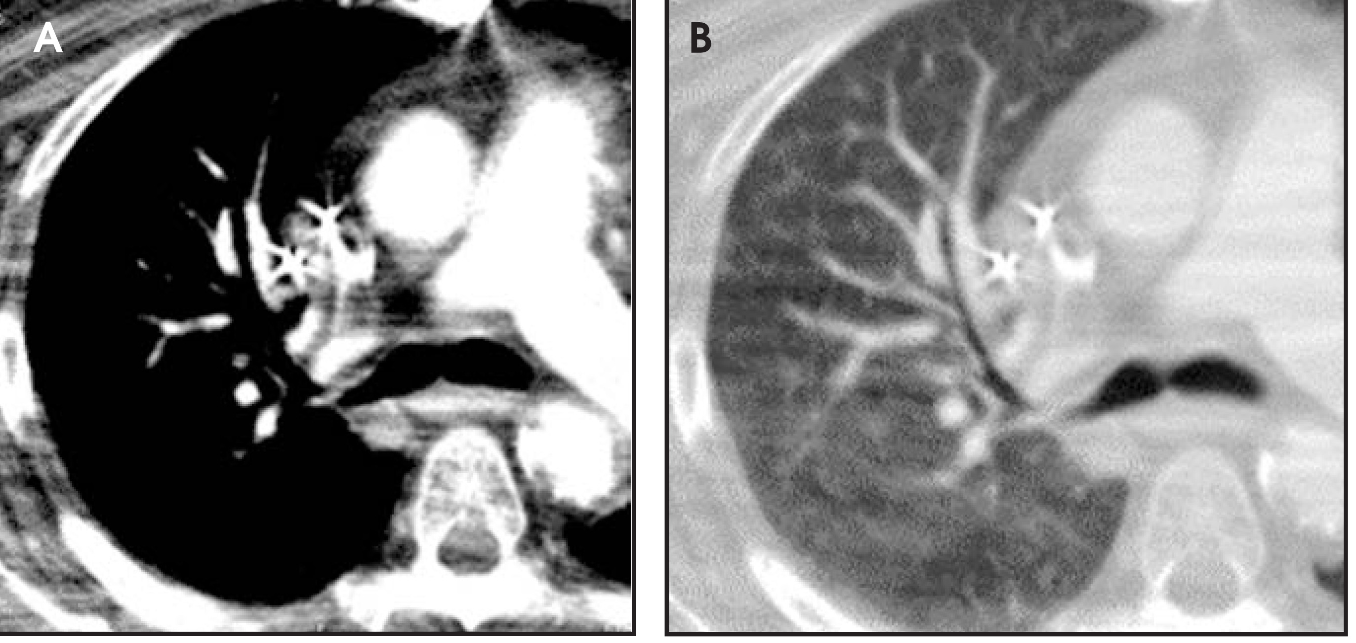 FIGURE 11.
