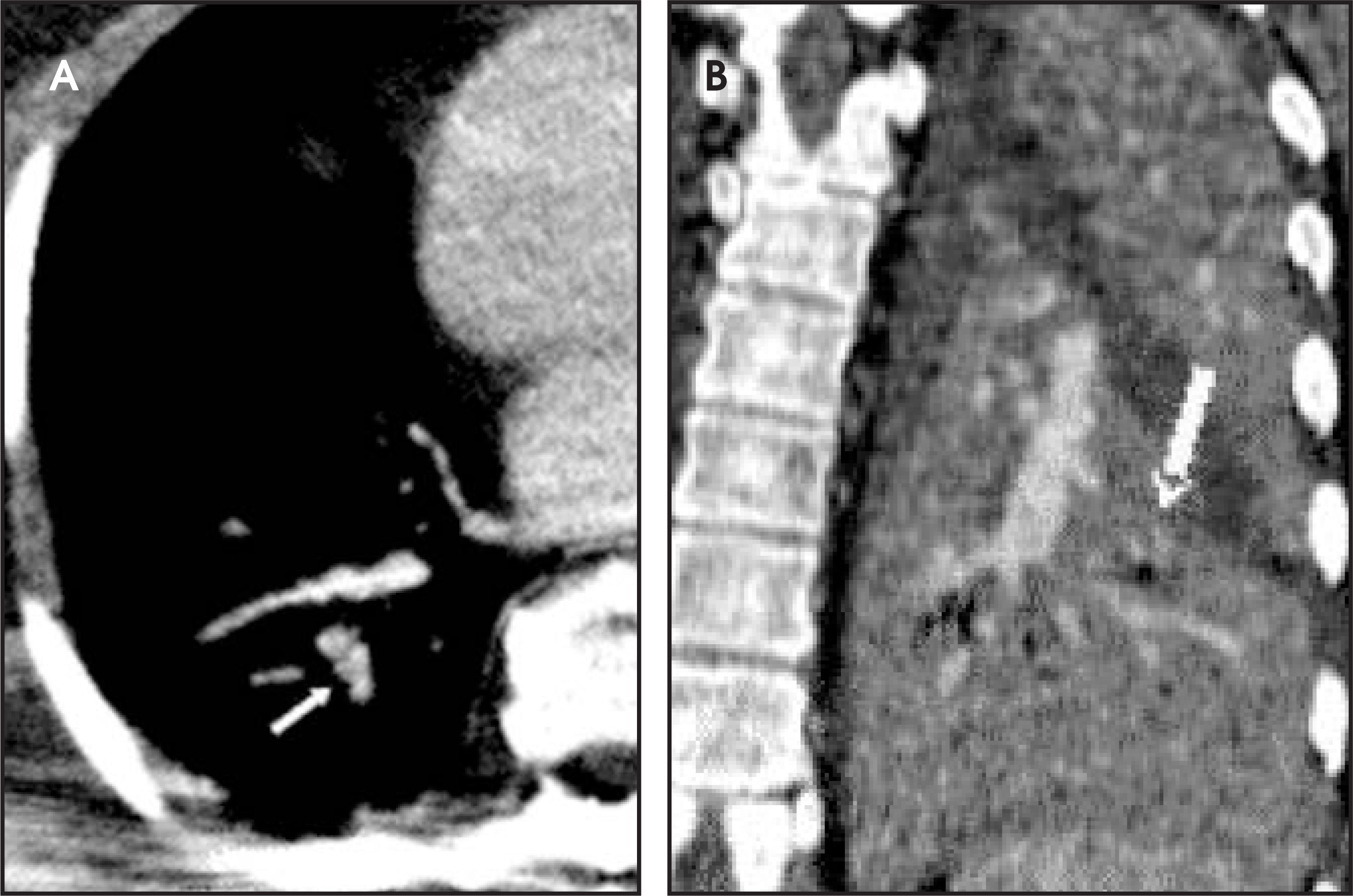 FIGURE 13.