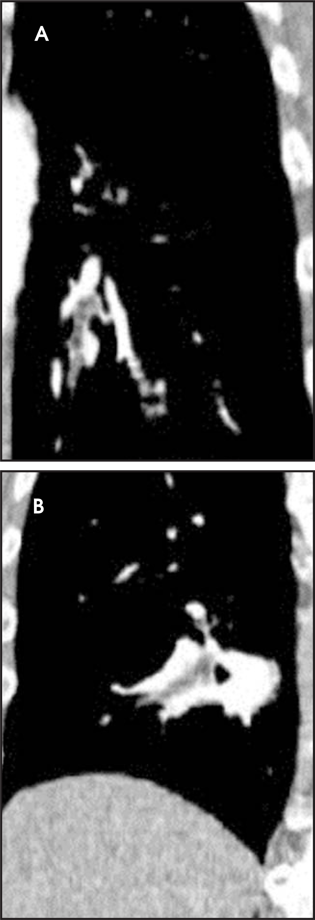 FIGURE 14.