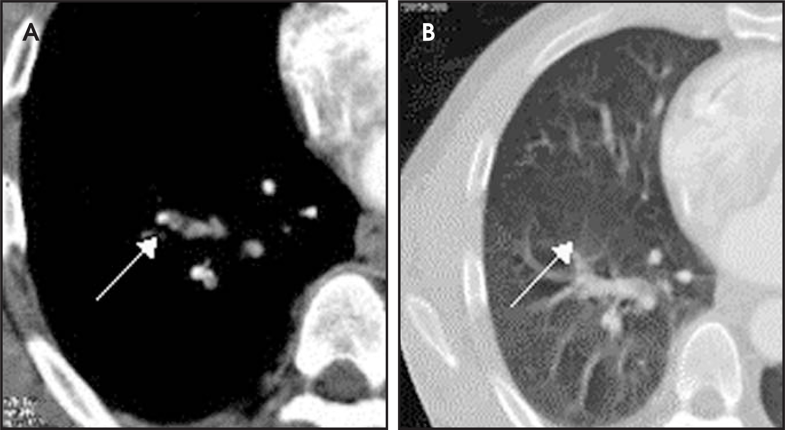 FIGURE 15.