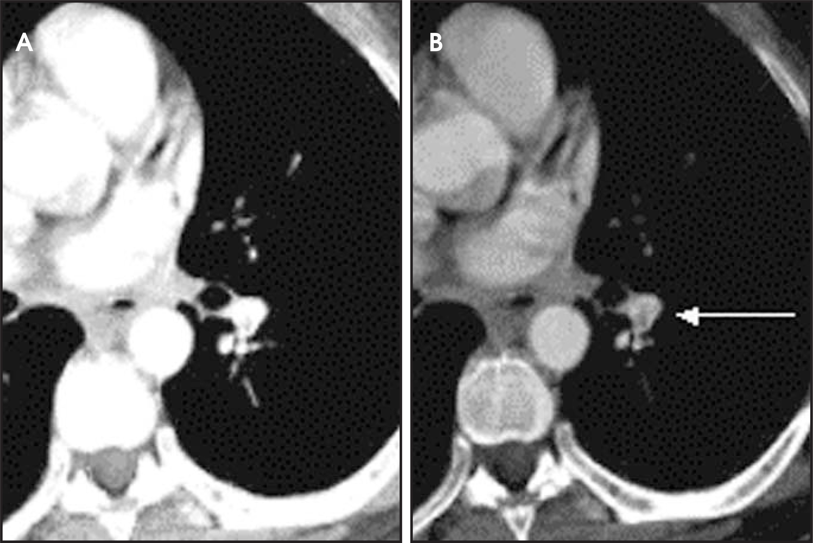 FIGURE 16.