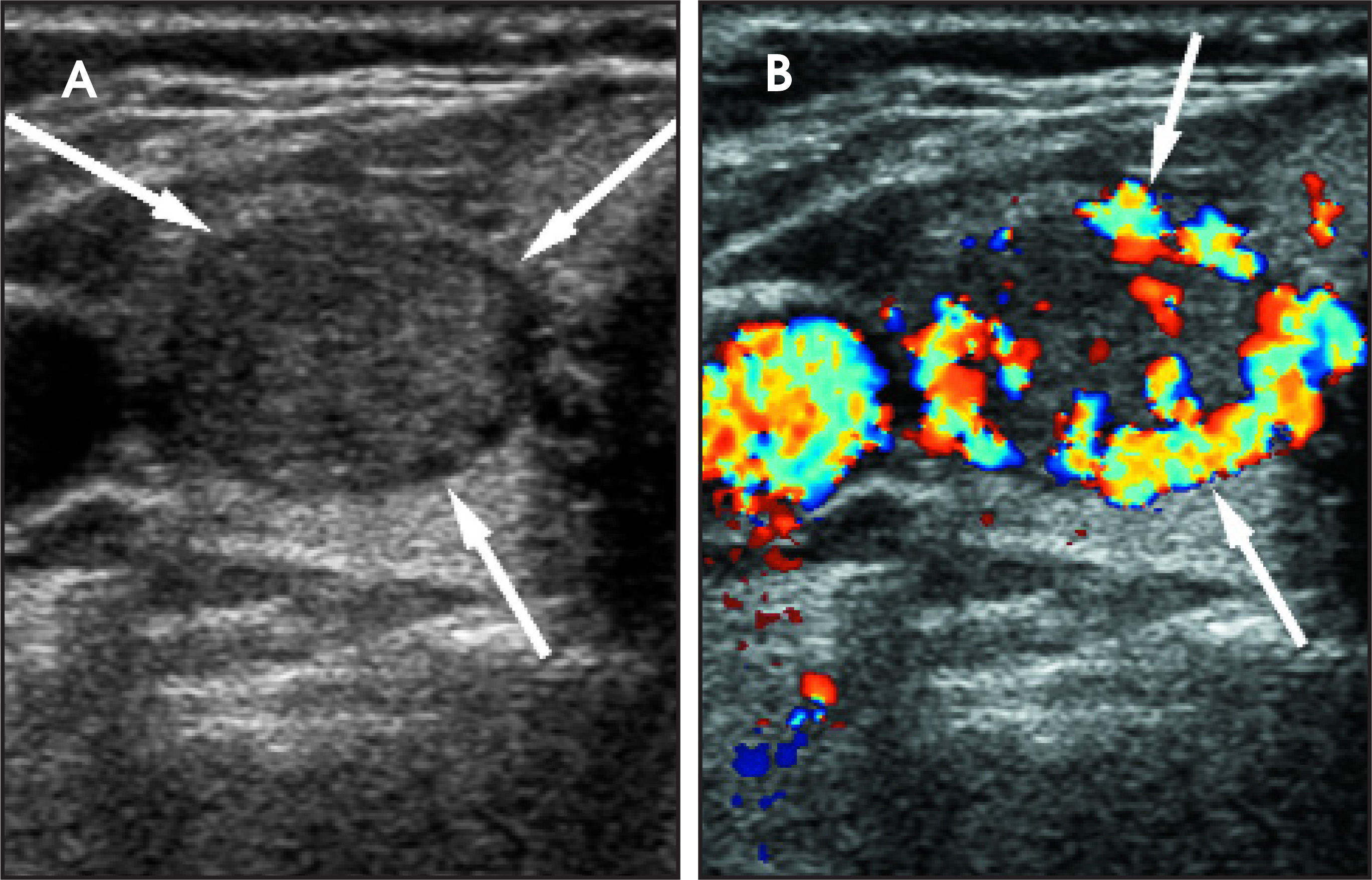 FIGURE 11.