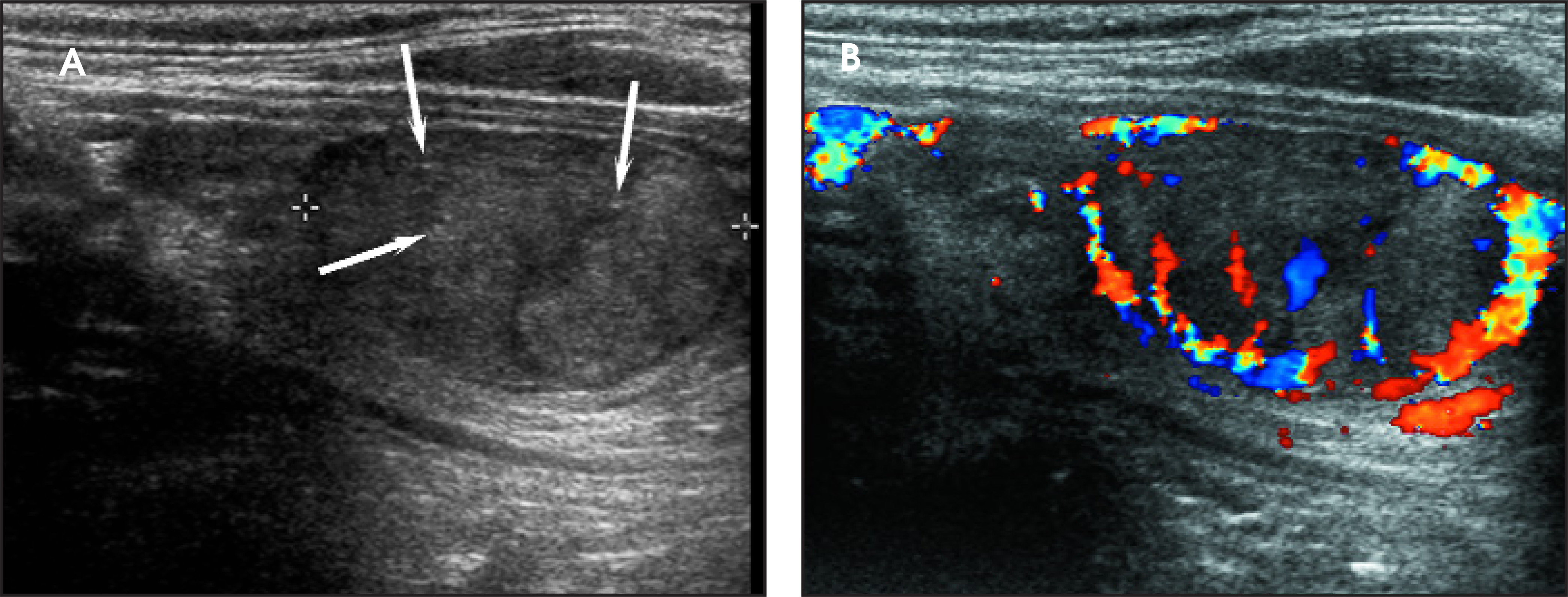 FIGURE 12.