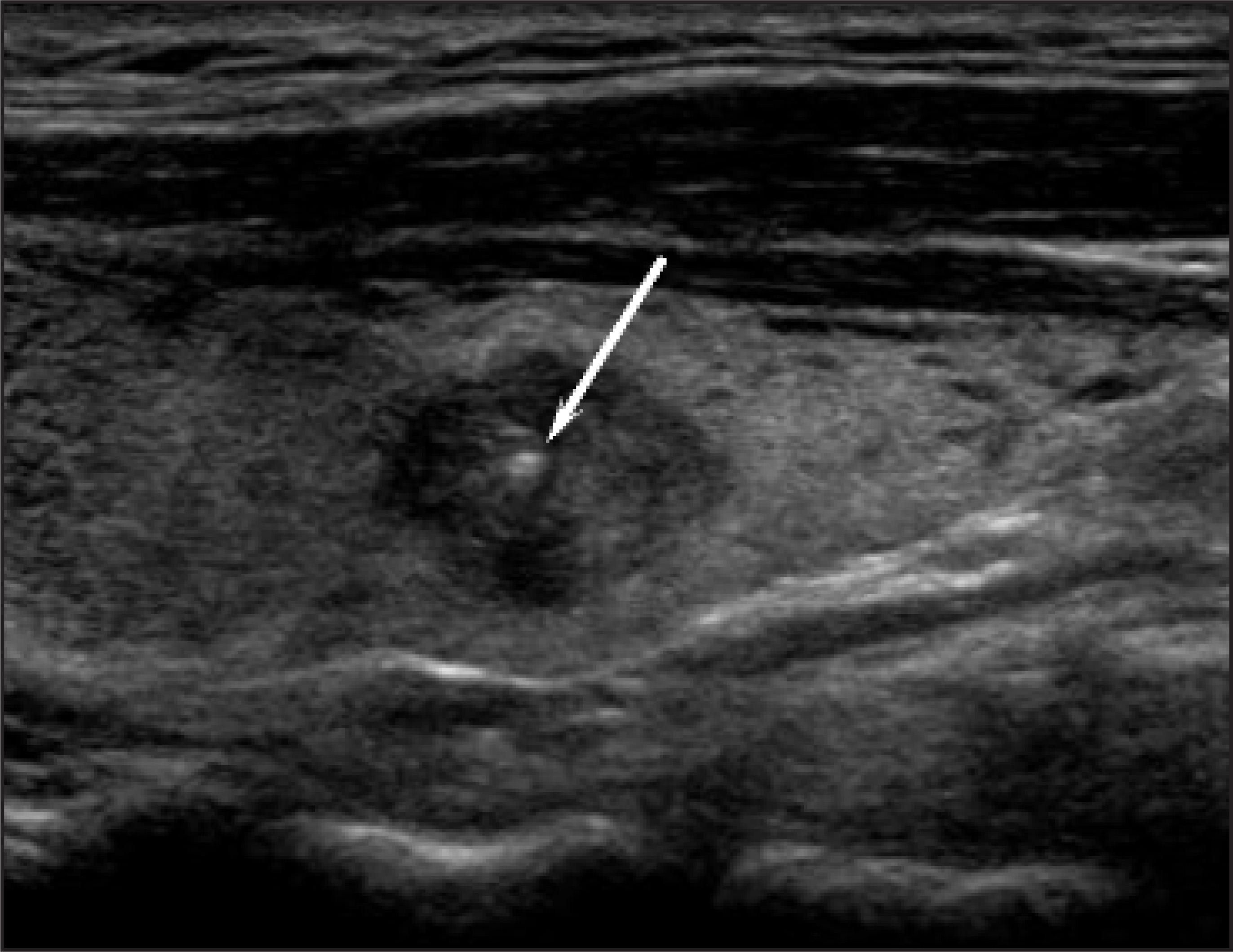 FIGURE 13.
