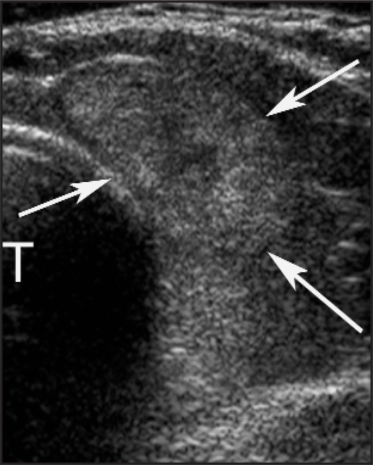 FIGURE 14.