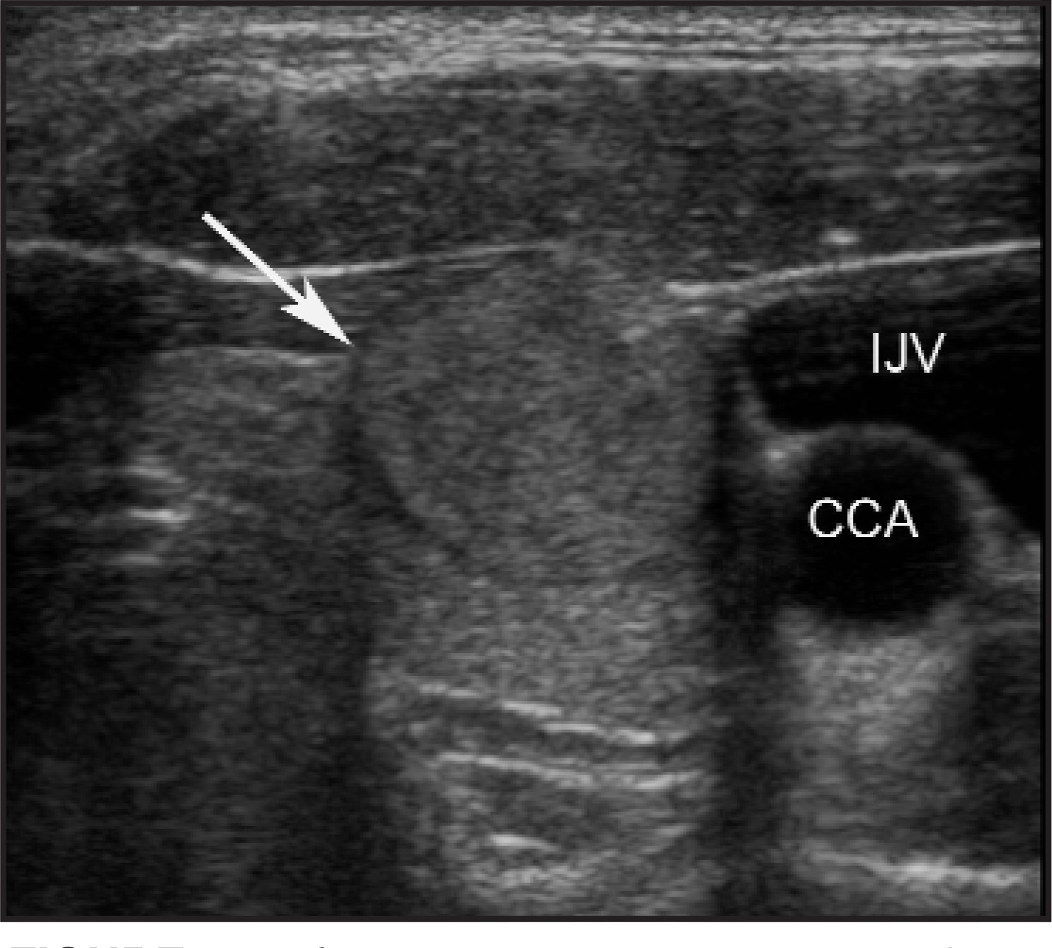 FIGURE 15.