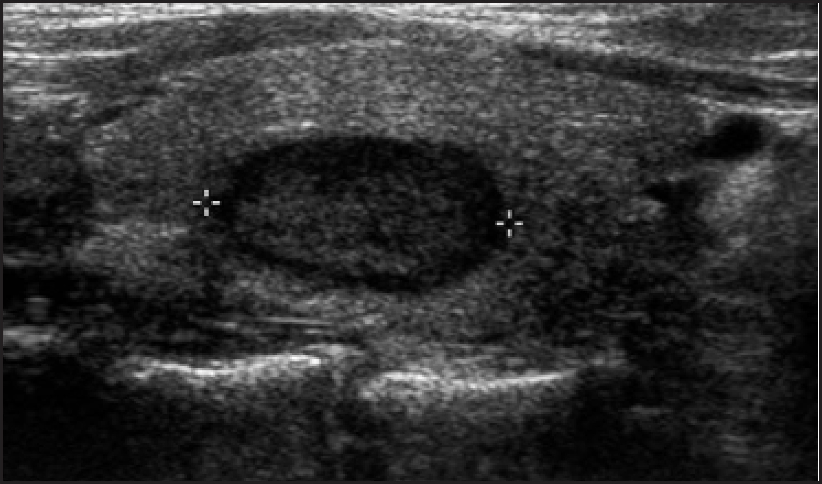 FIGURE 16.