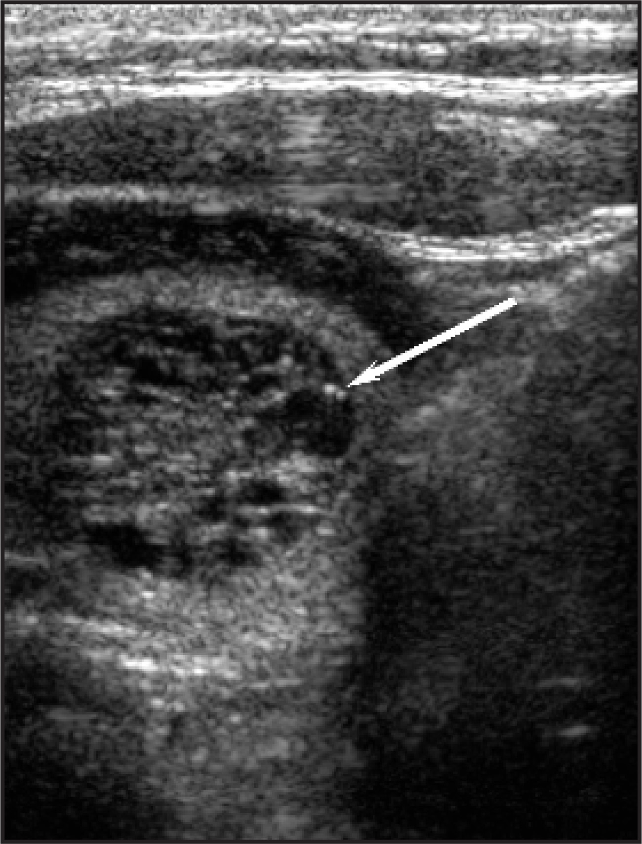 FIGURE 17.