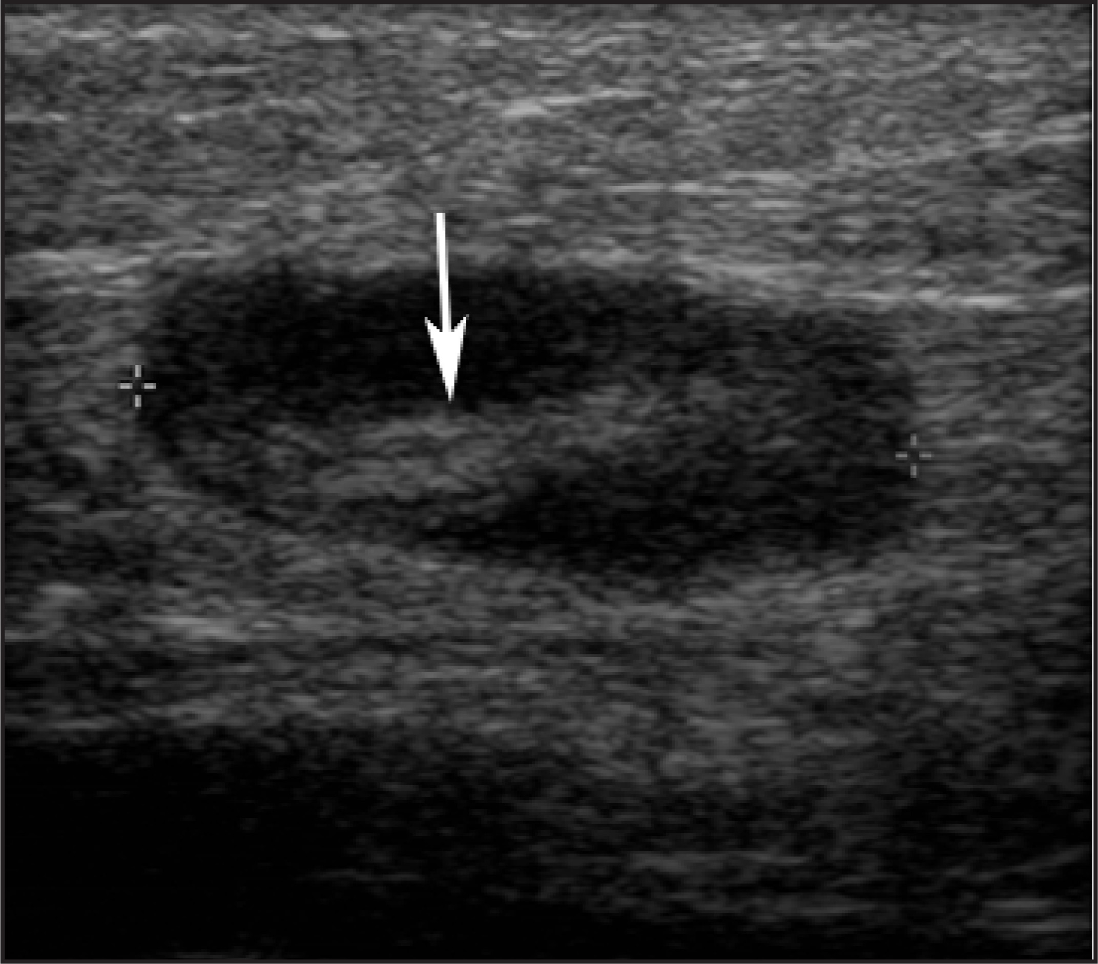 FIGURE 22.