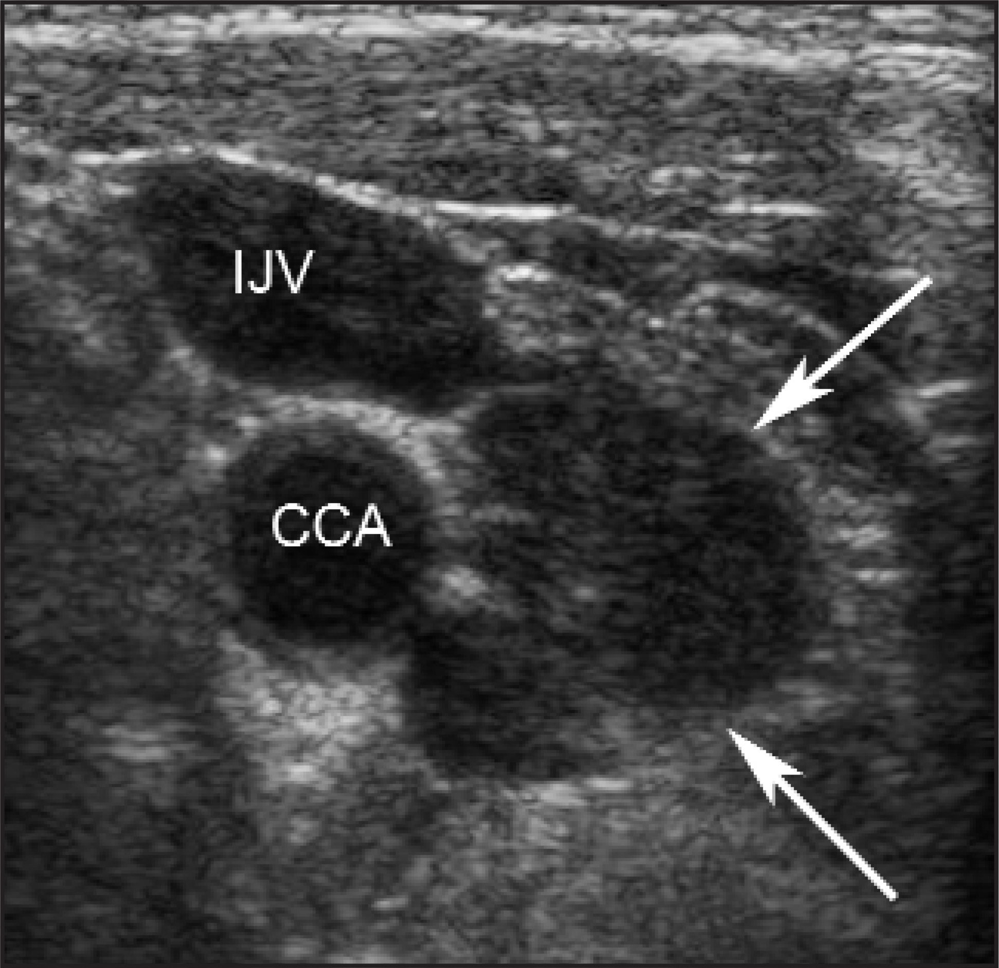FIGURE 23.