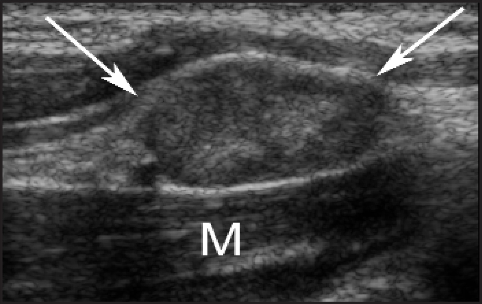 FIGURE 26.