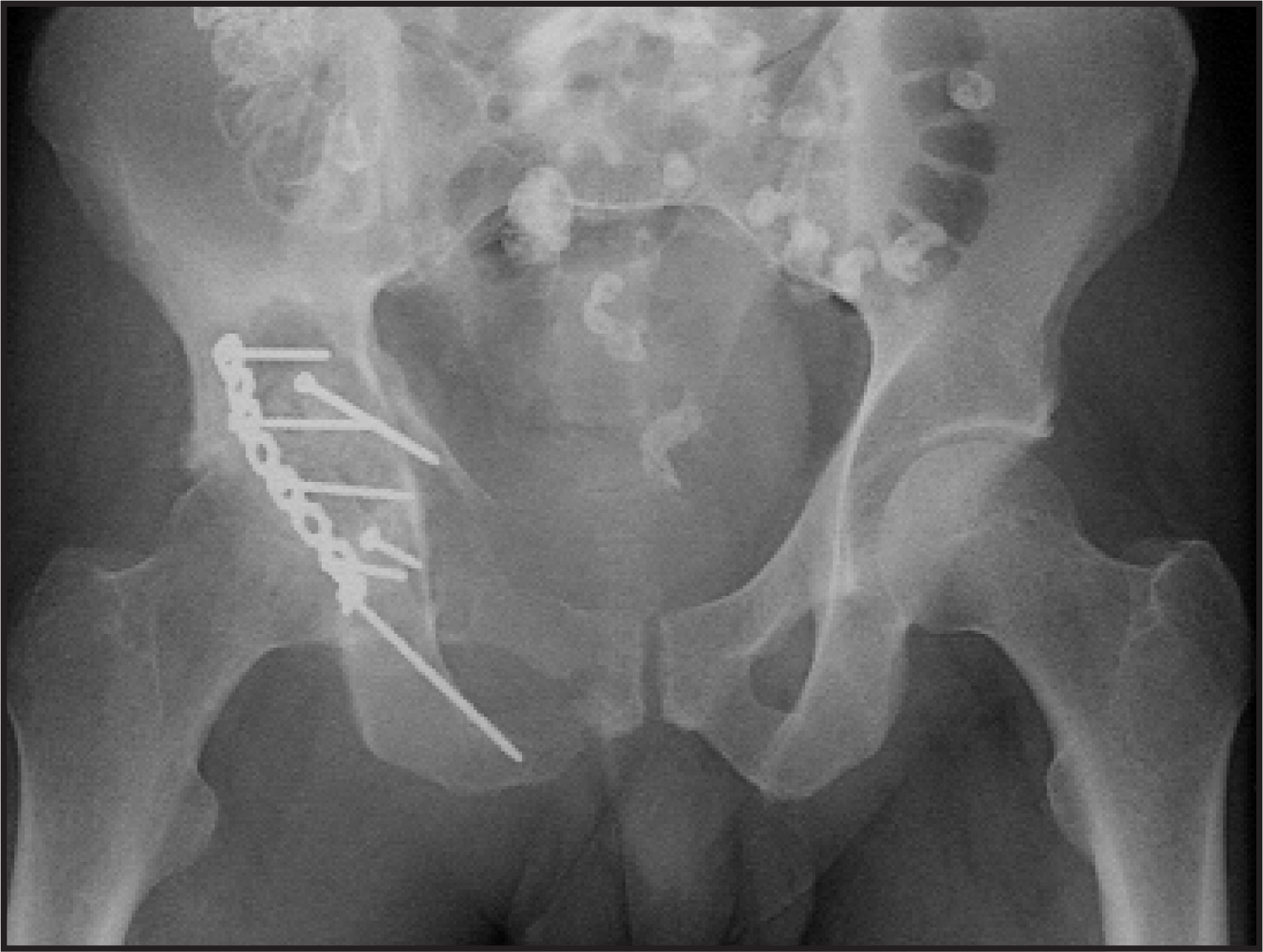 FIGURE 1.