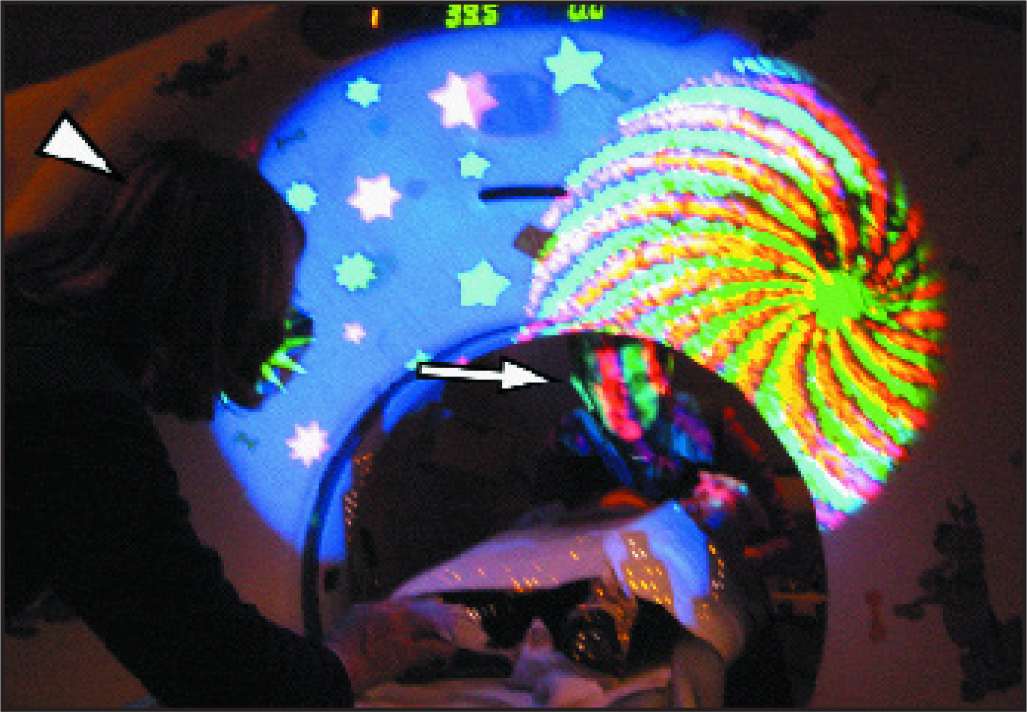 FIGURE 5.
