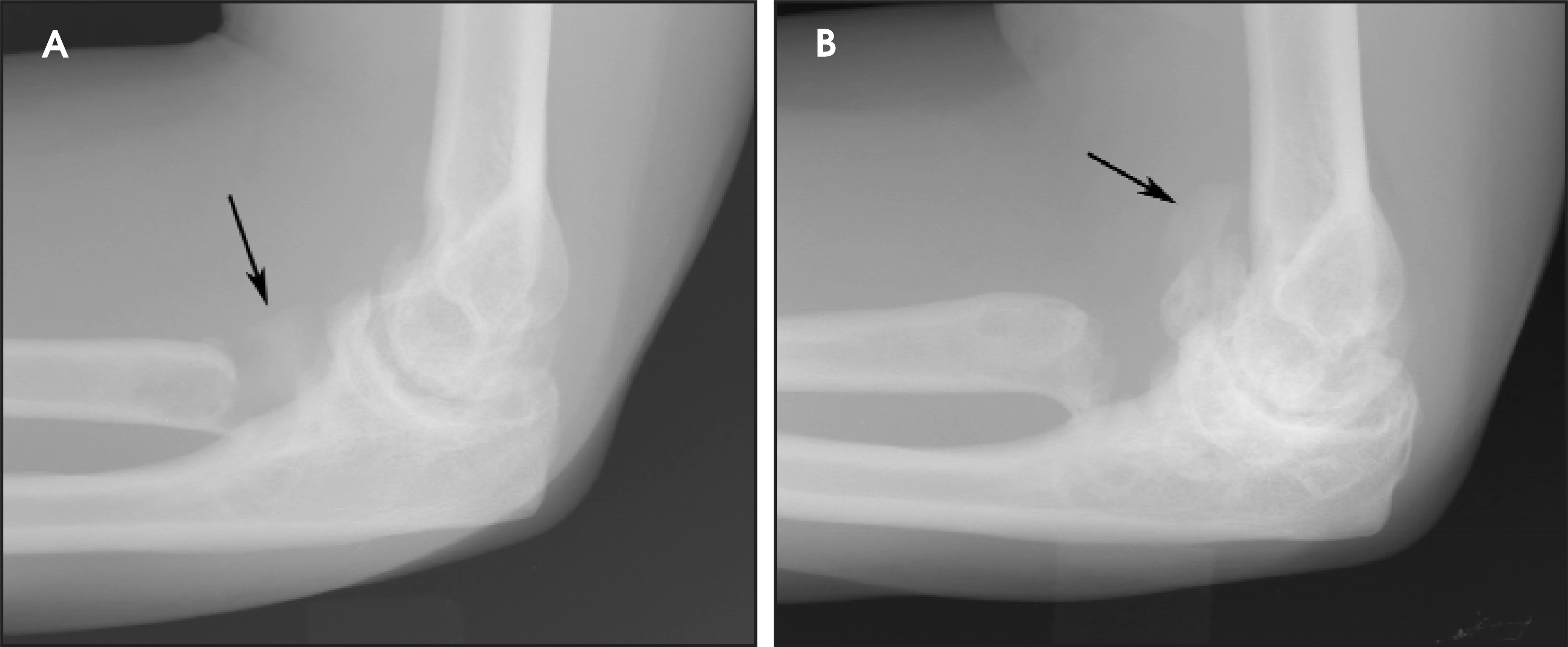FIGURE 4.