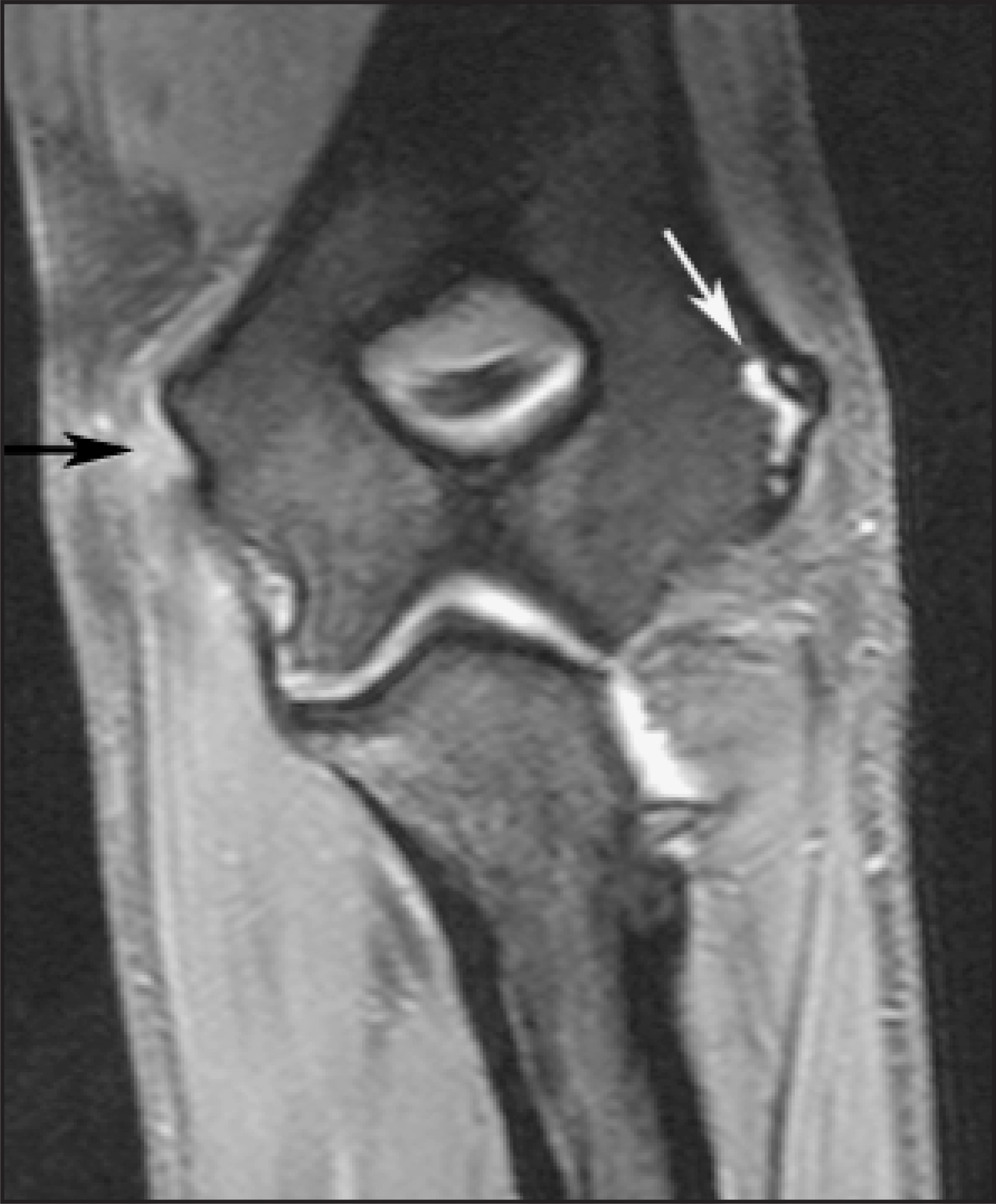 FIGURE 11.