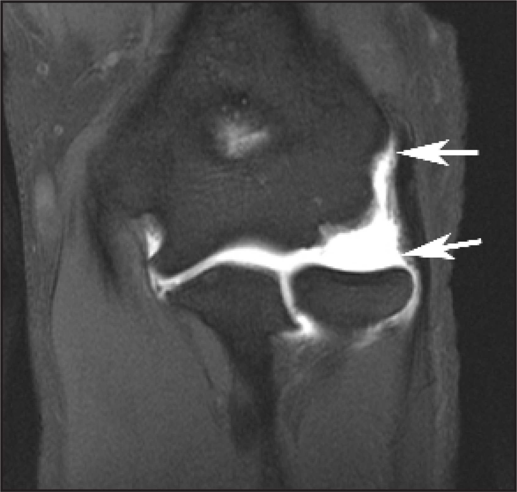 FIGURE 13.