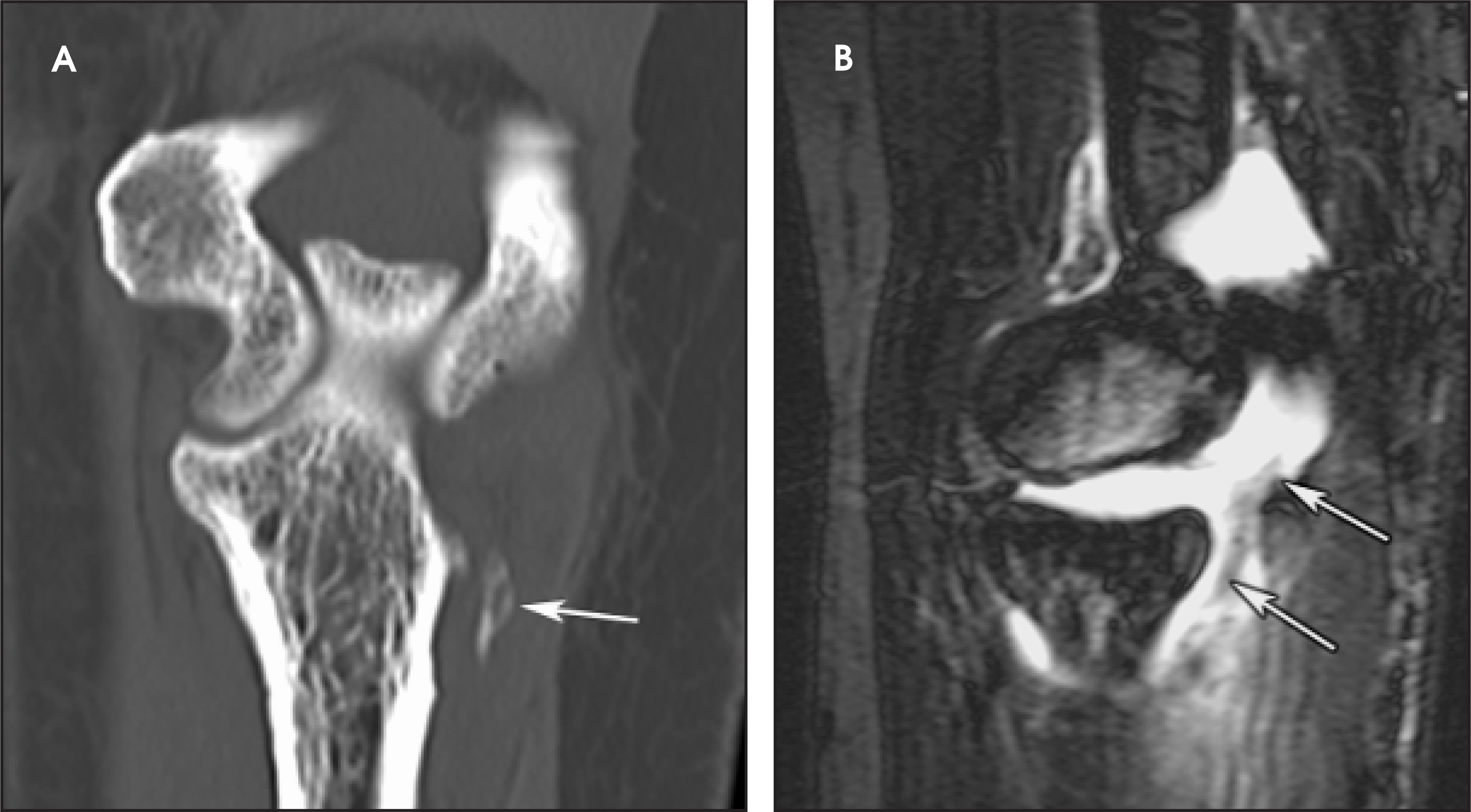FIGURE 14.