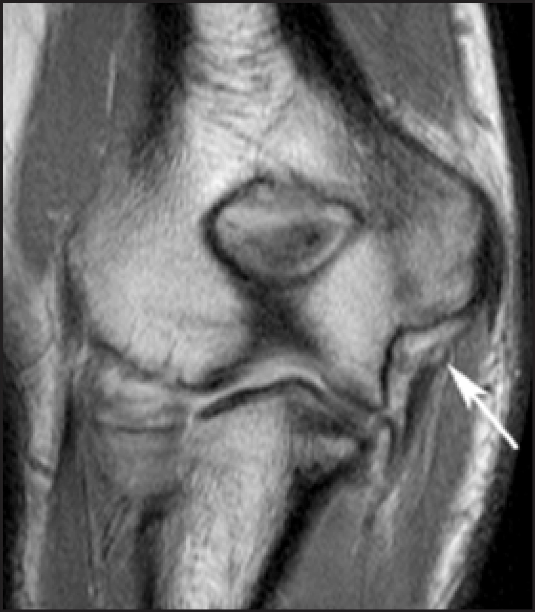 FIGURE 16.