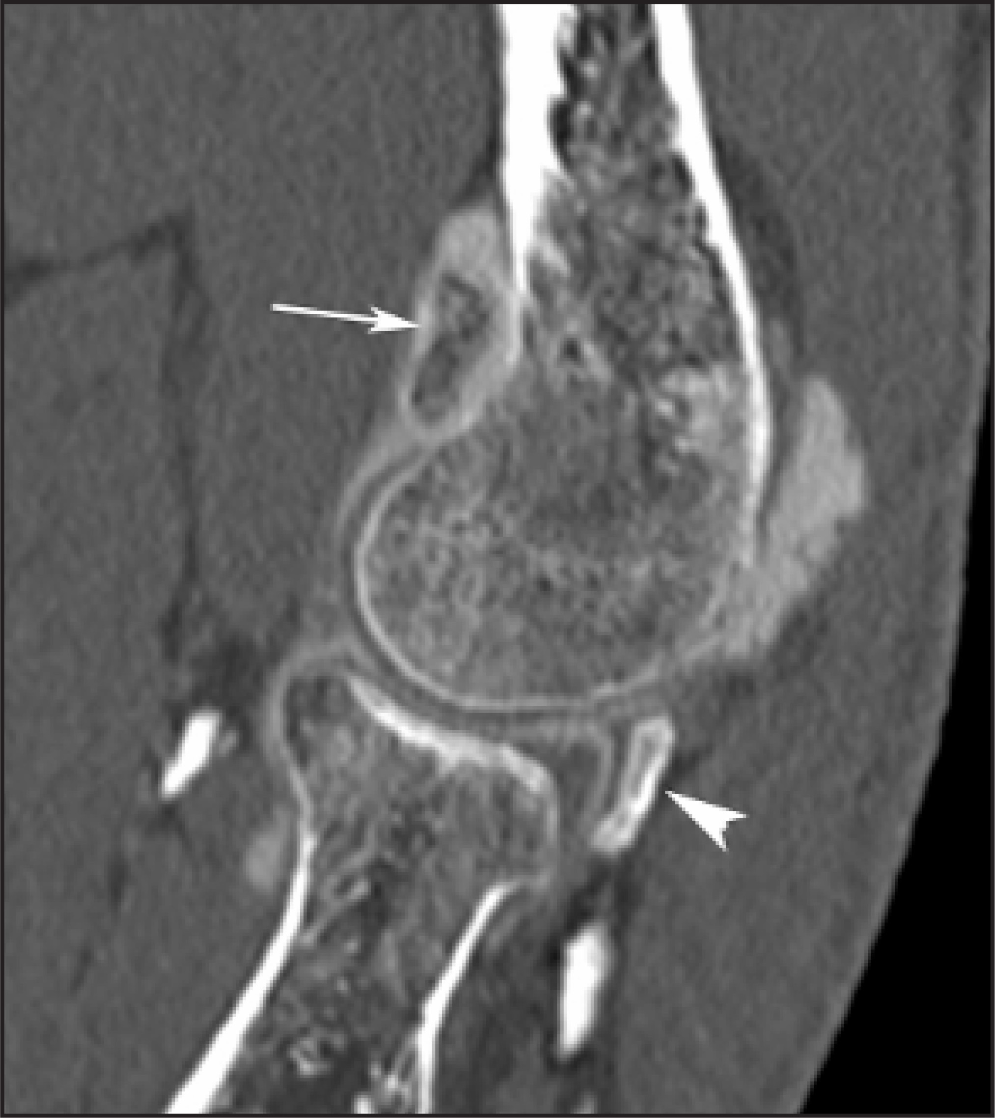 FIGURE 17.