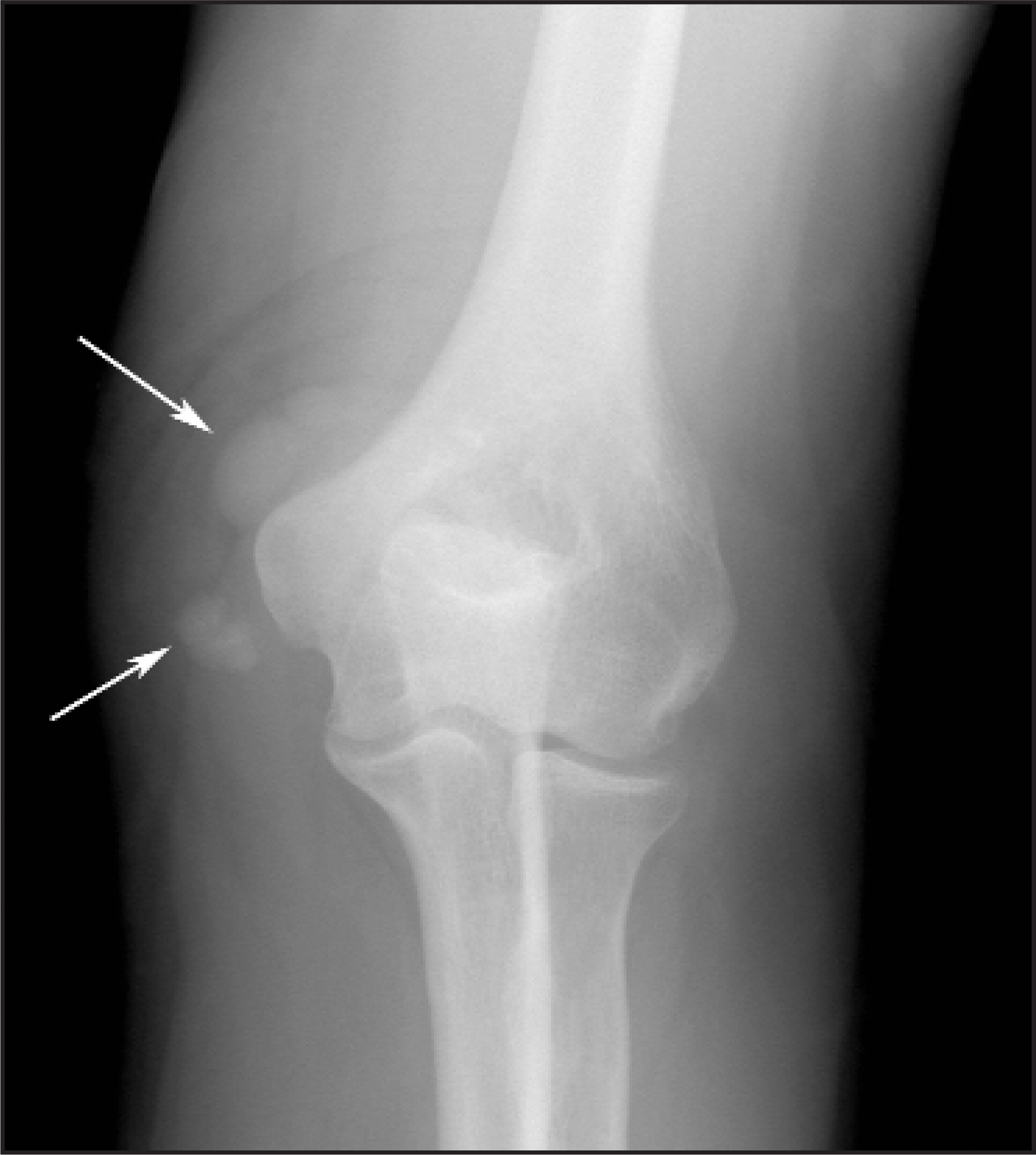 FIGURE 18.