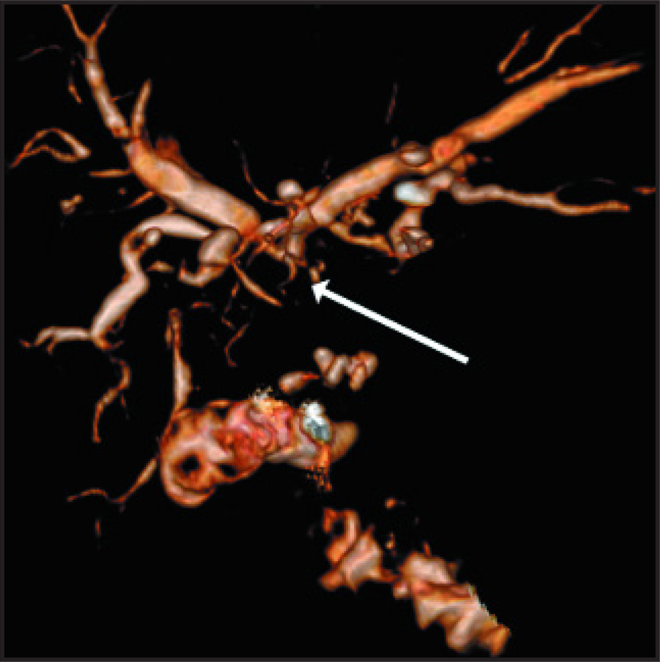 FIGURE 11.