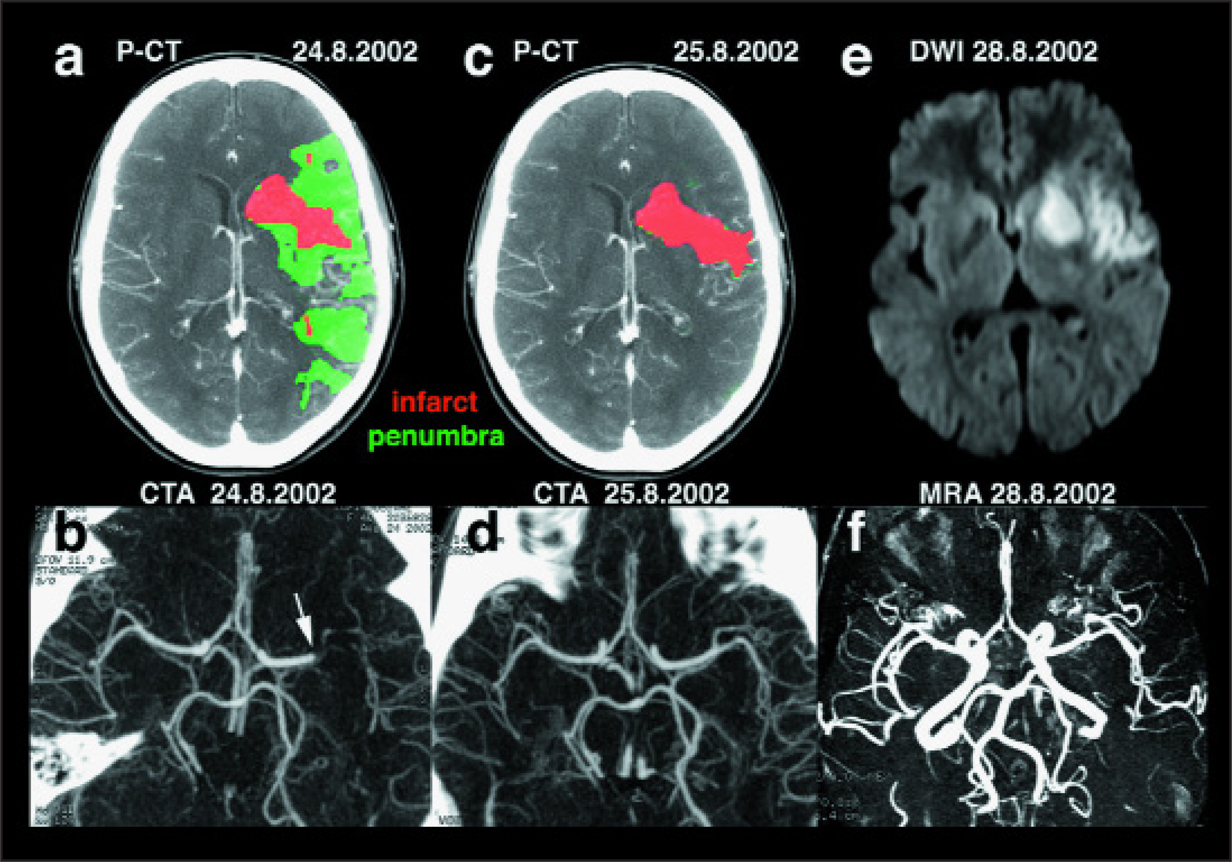 FIGURE 4.
