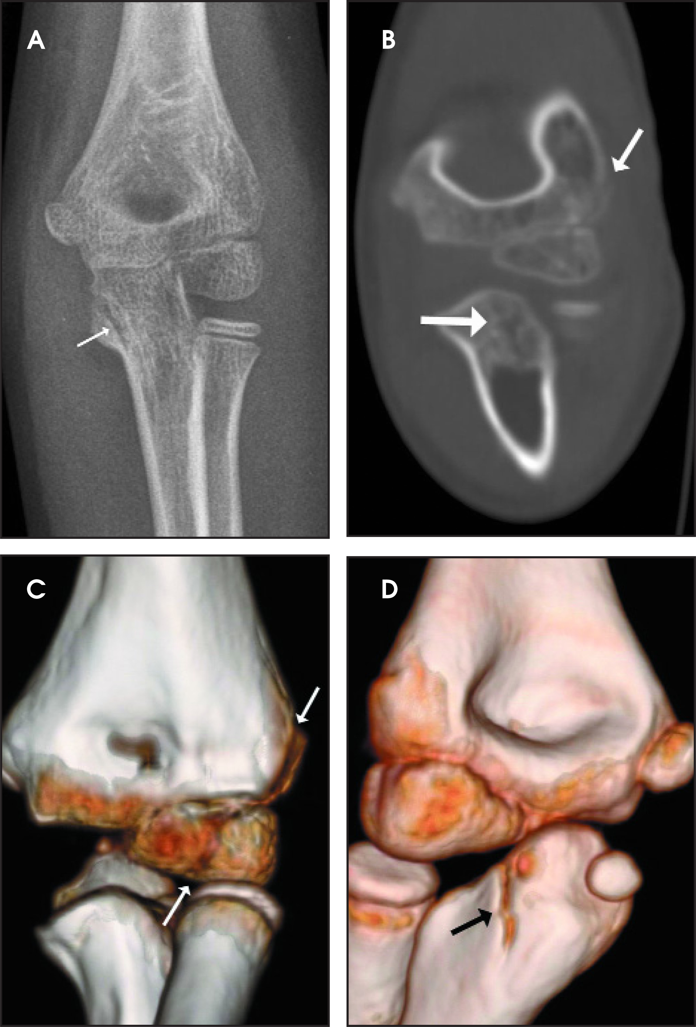 FIGURE 4.