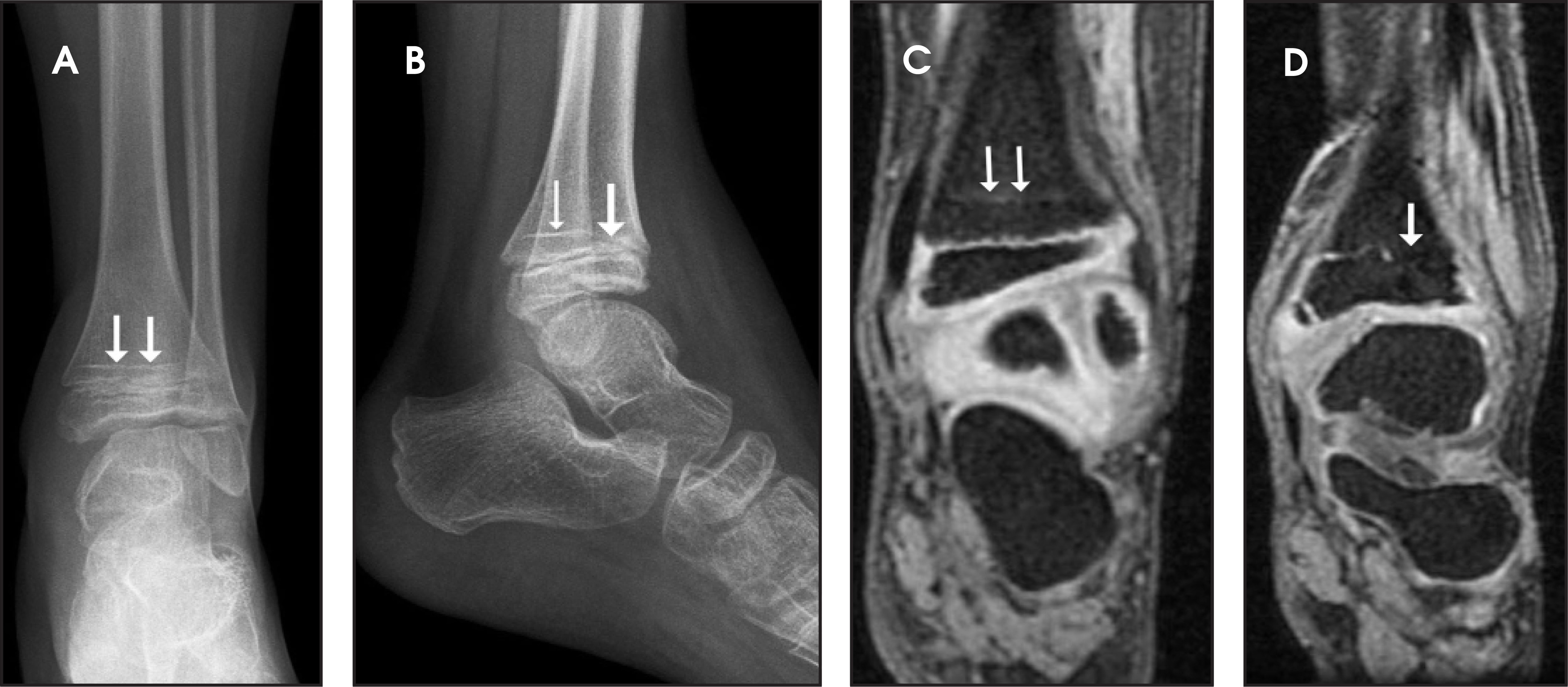 FIGURE 11.