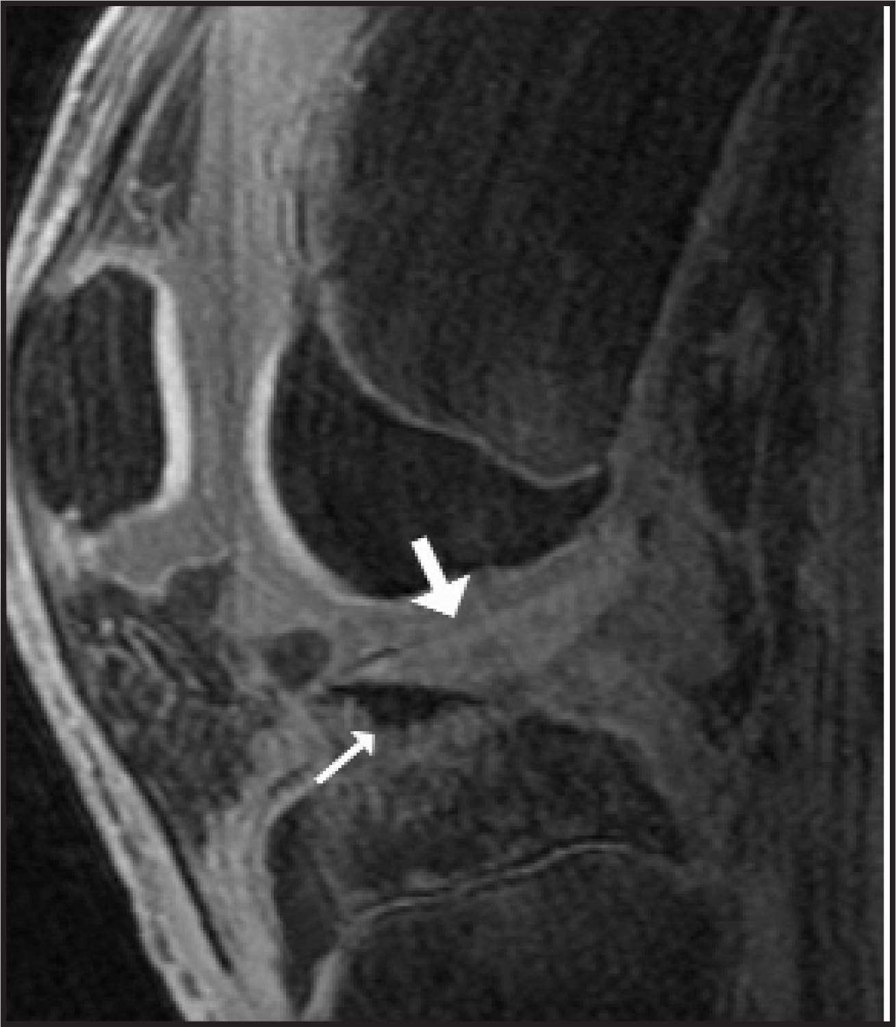 FIGURE 13.