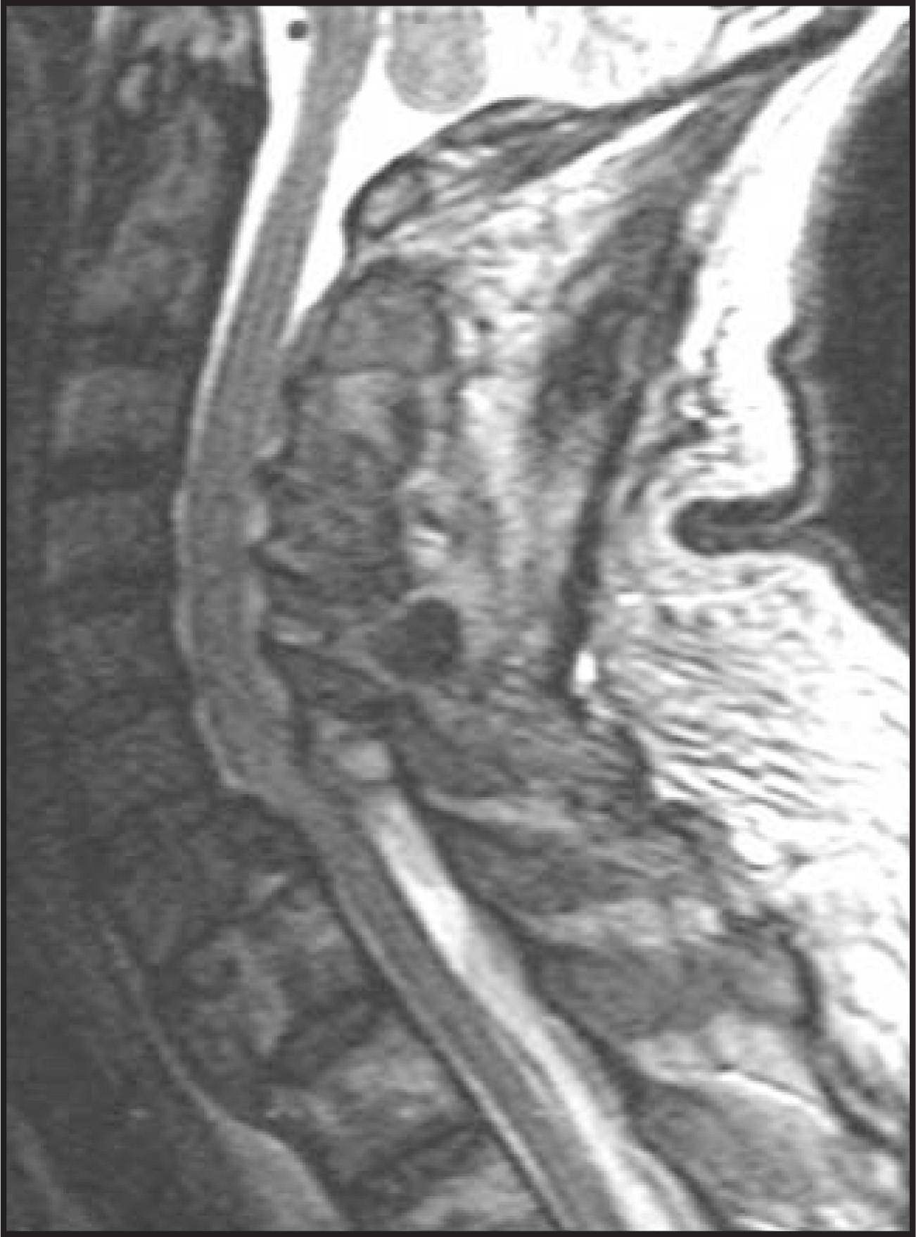 FIGURE 11.