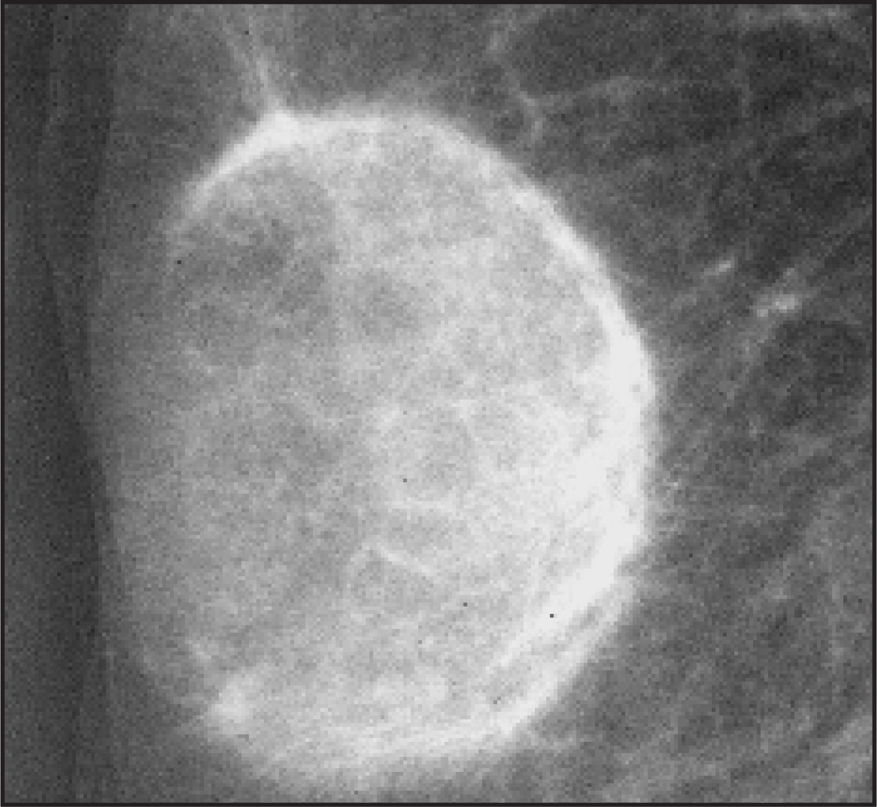 FIGURE 4.