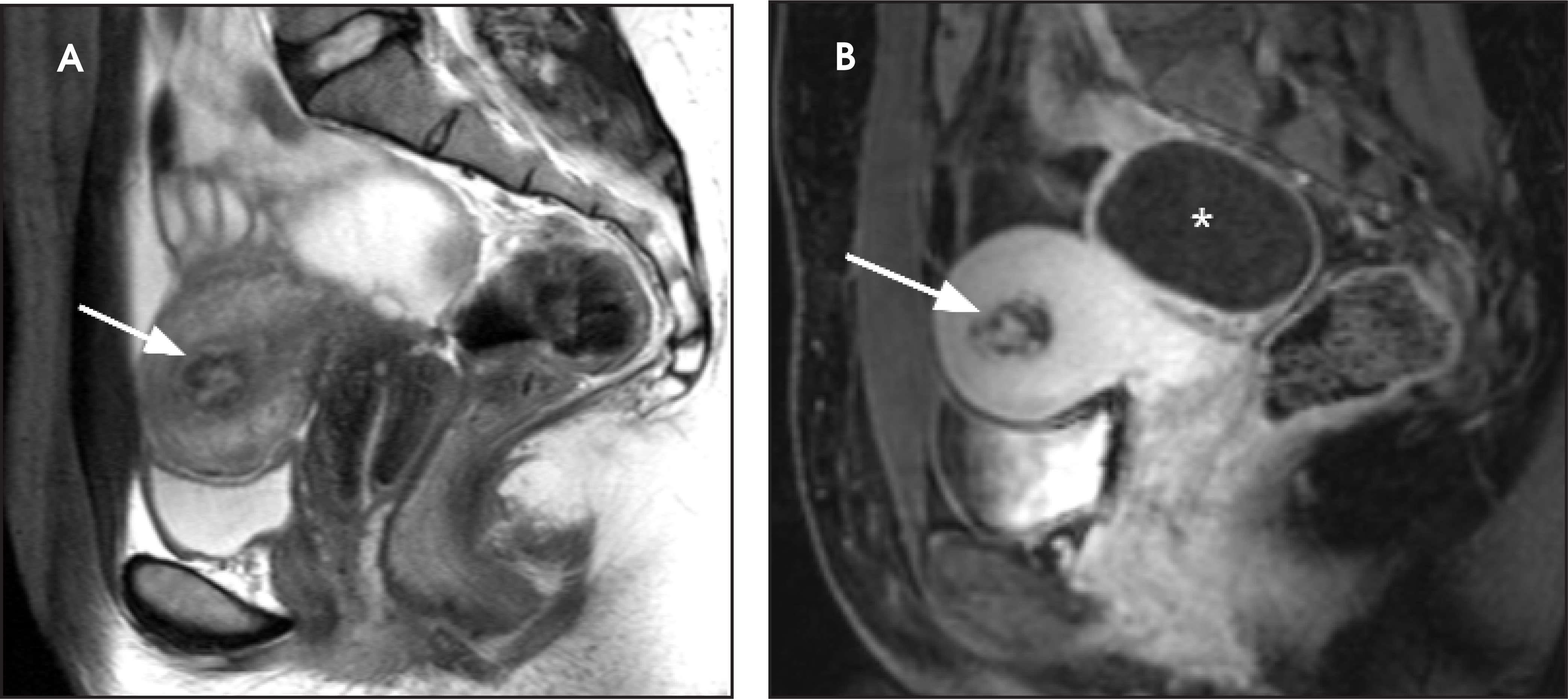 FIGURE 11.