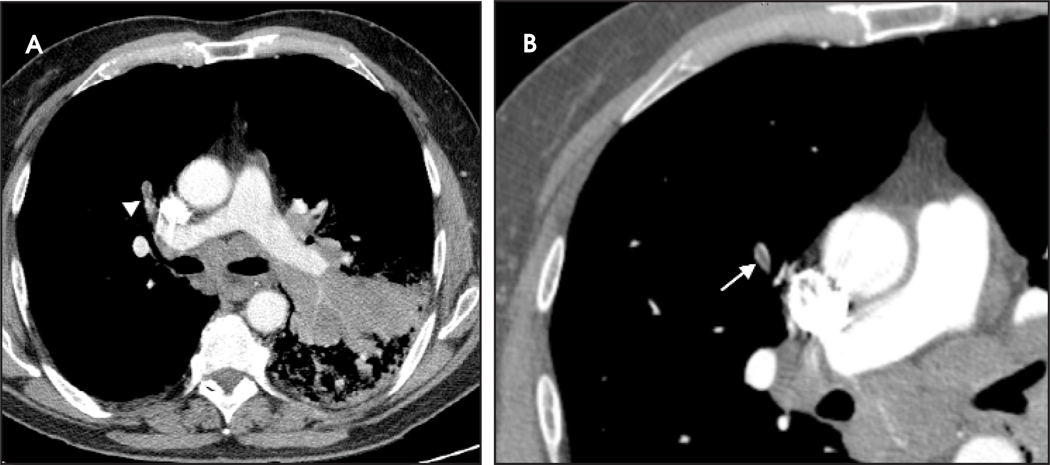 FIGURE 4.