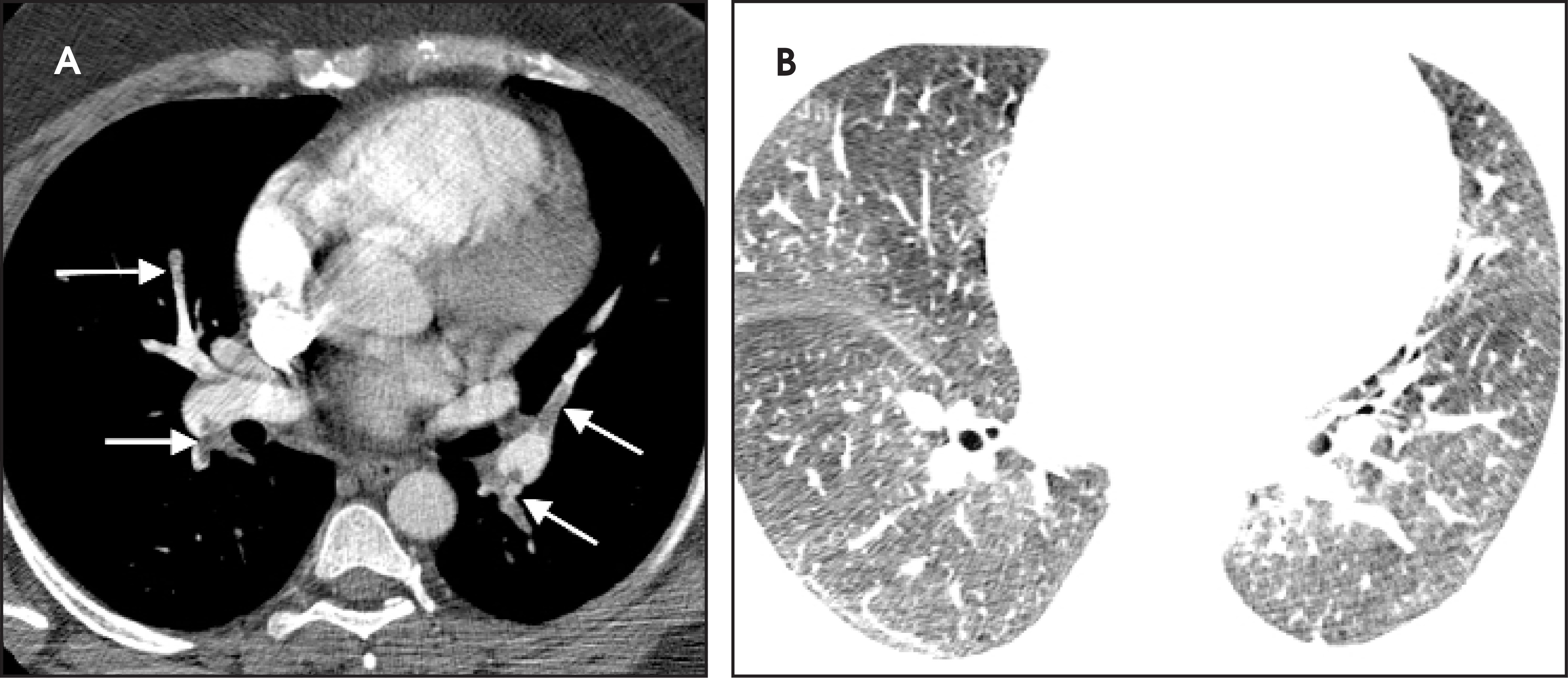 FIGURE 12.