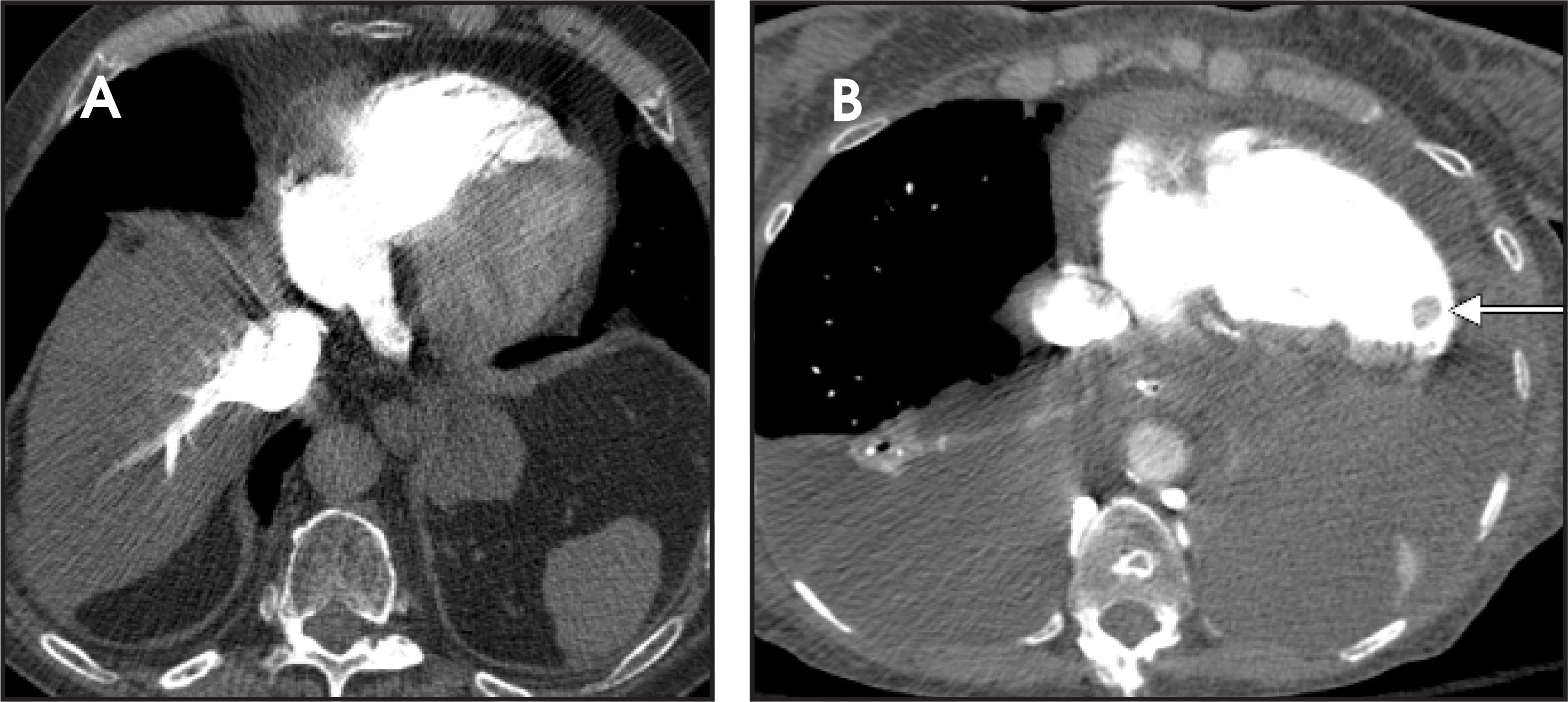 FIGURE 13.