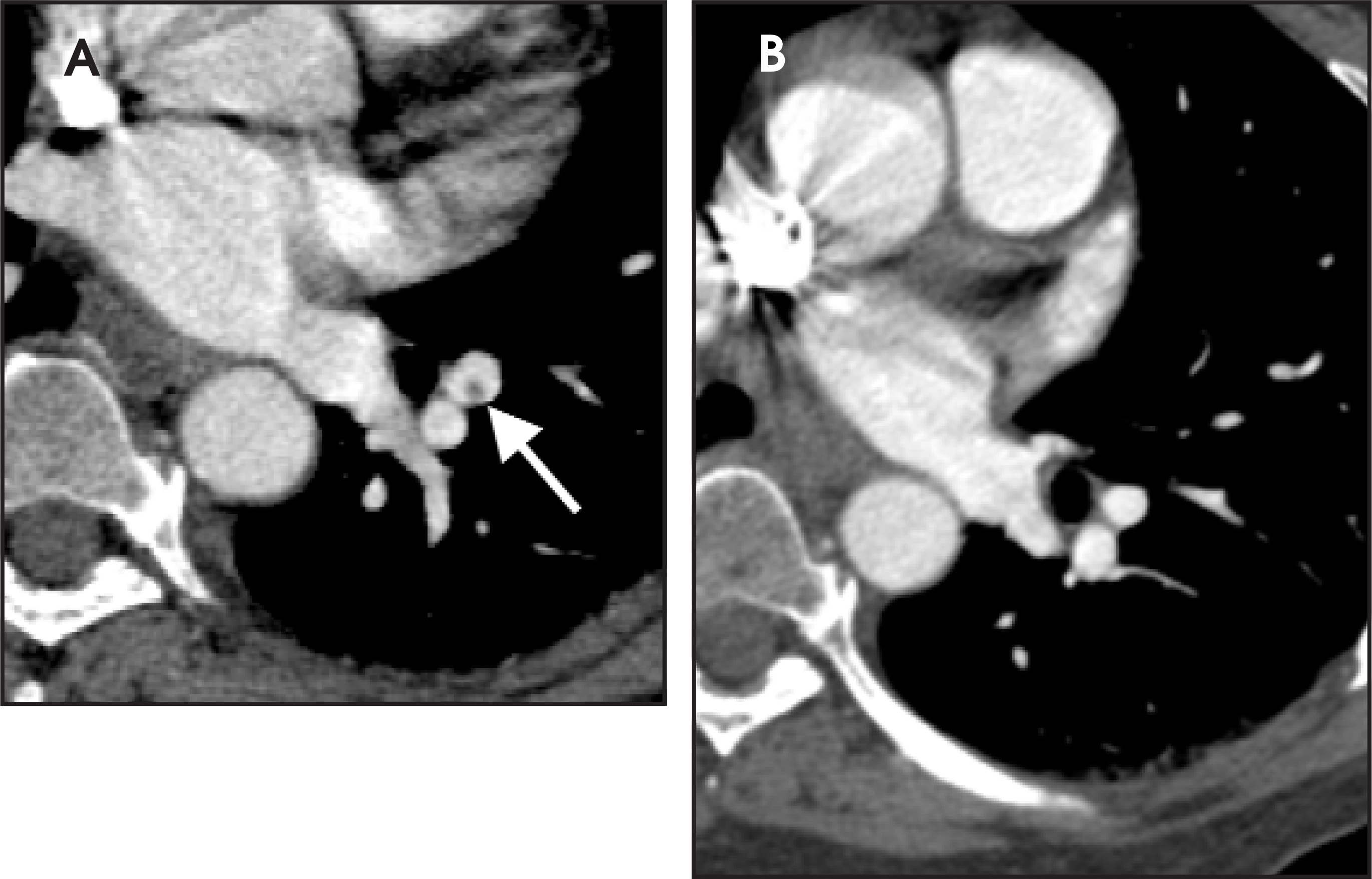 FIGURE 14.