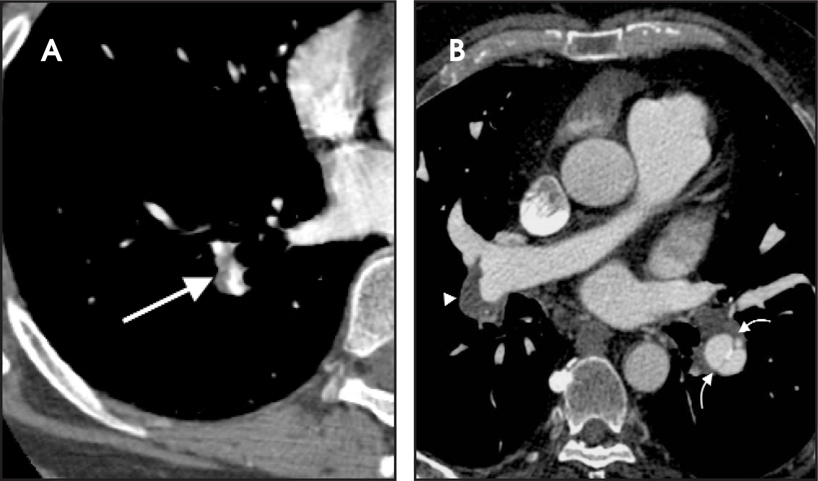 FIGURE 15.