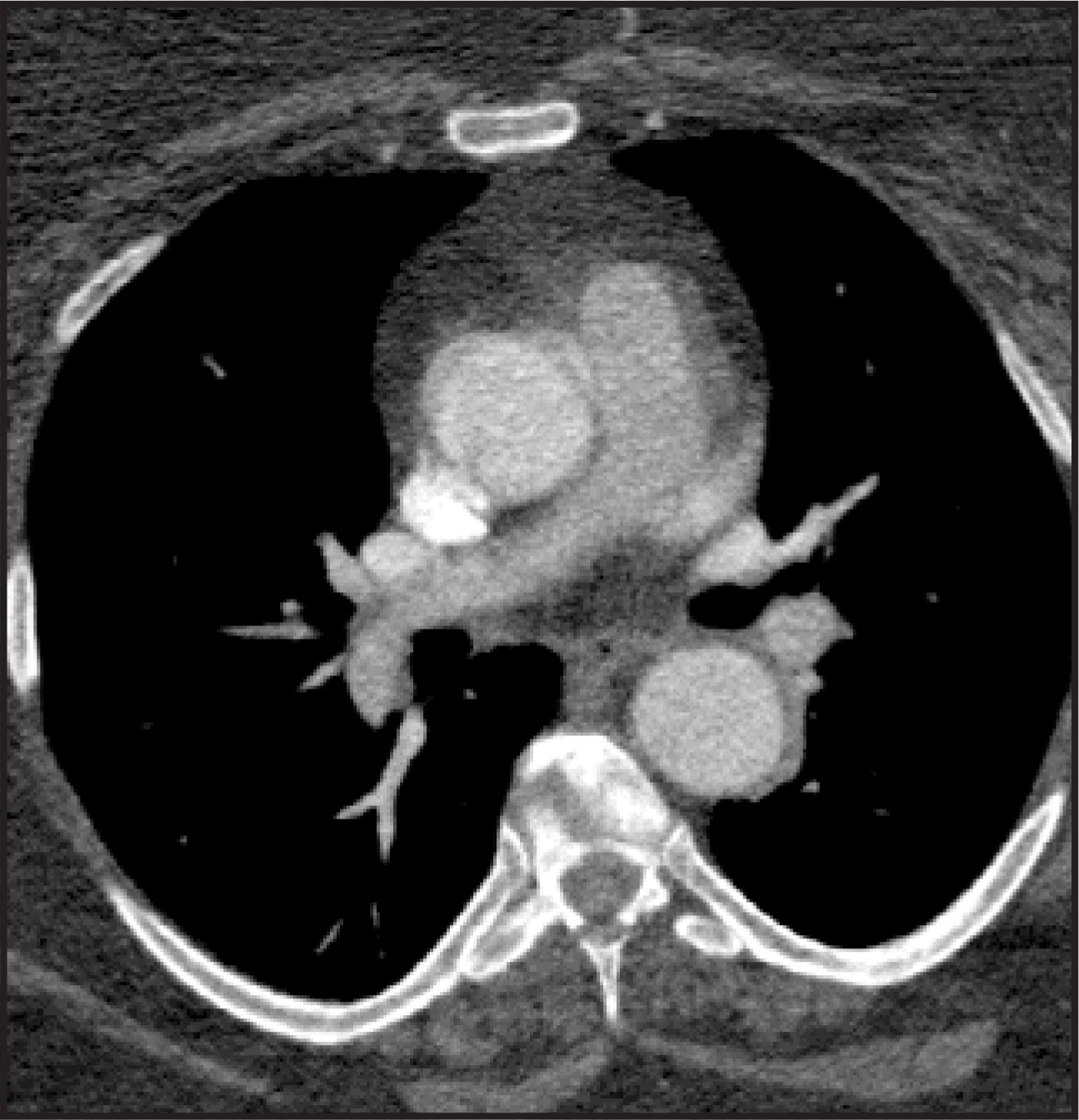 FIGURE 17.