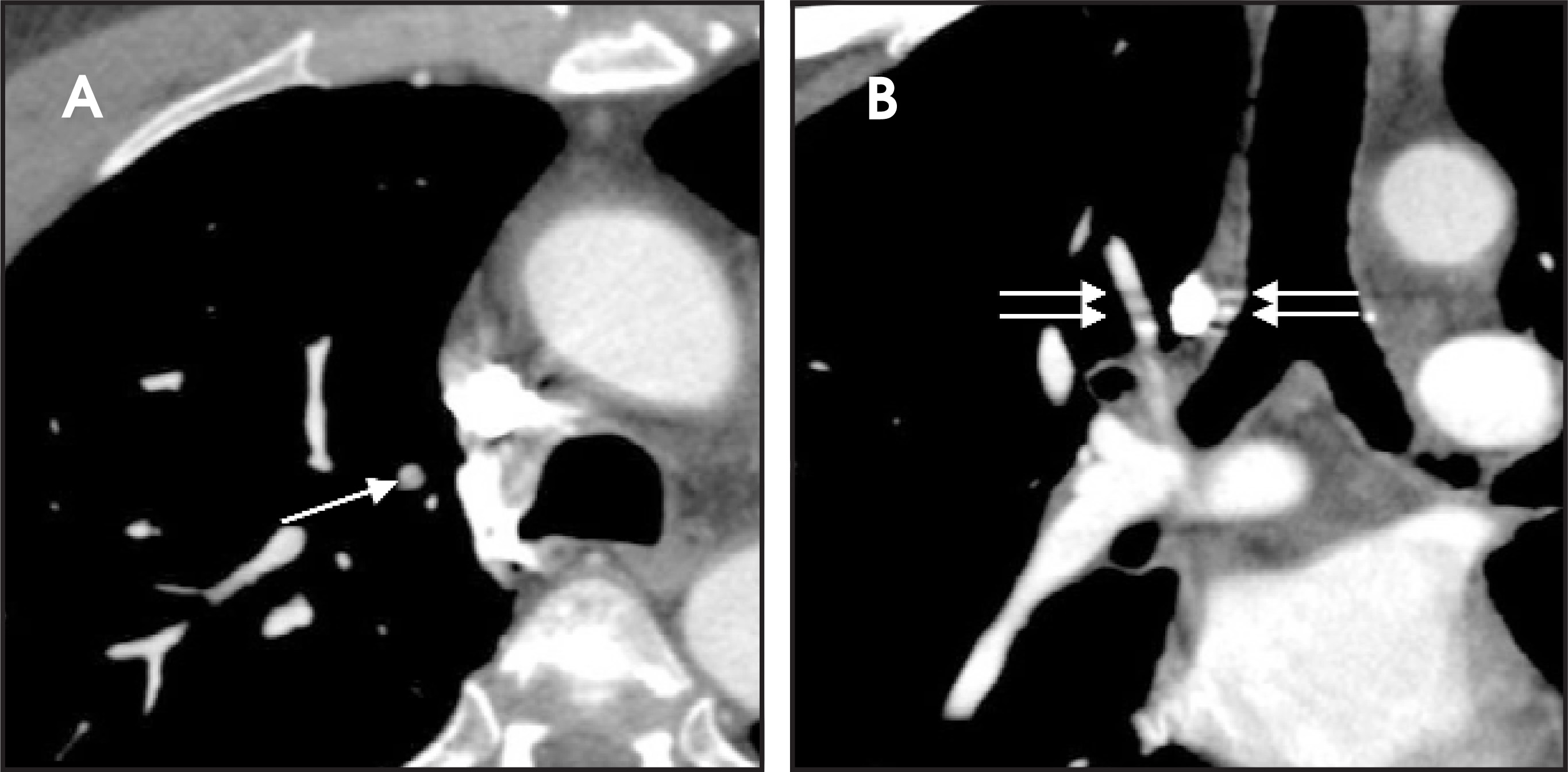FIGURE 18.