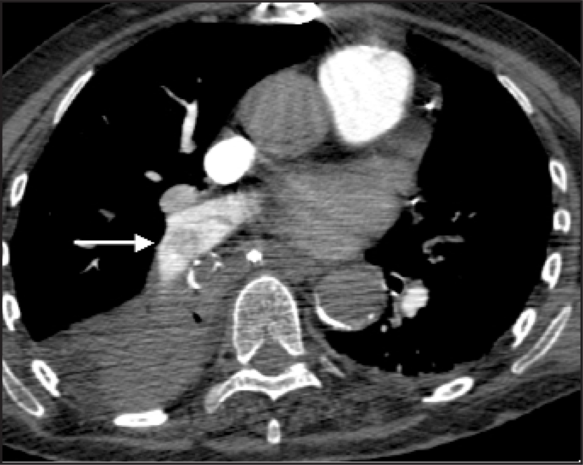 FIGURE 20.