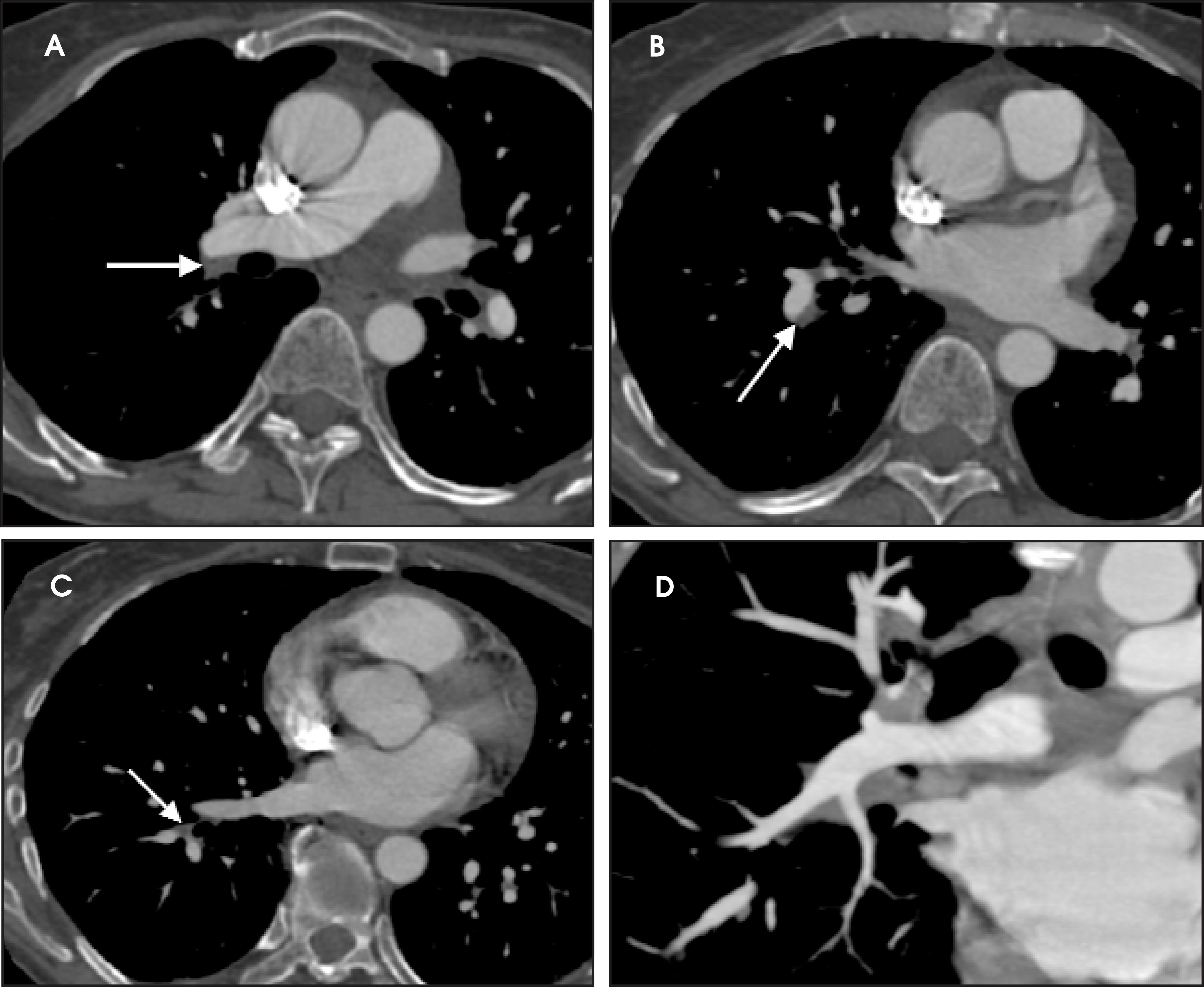 FIGURE 21.