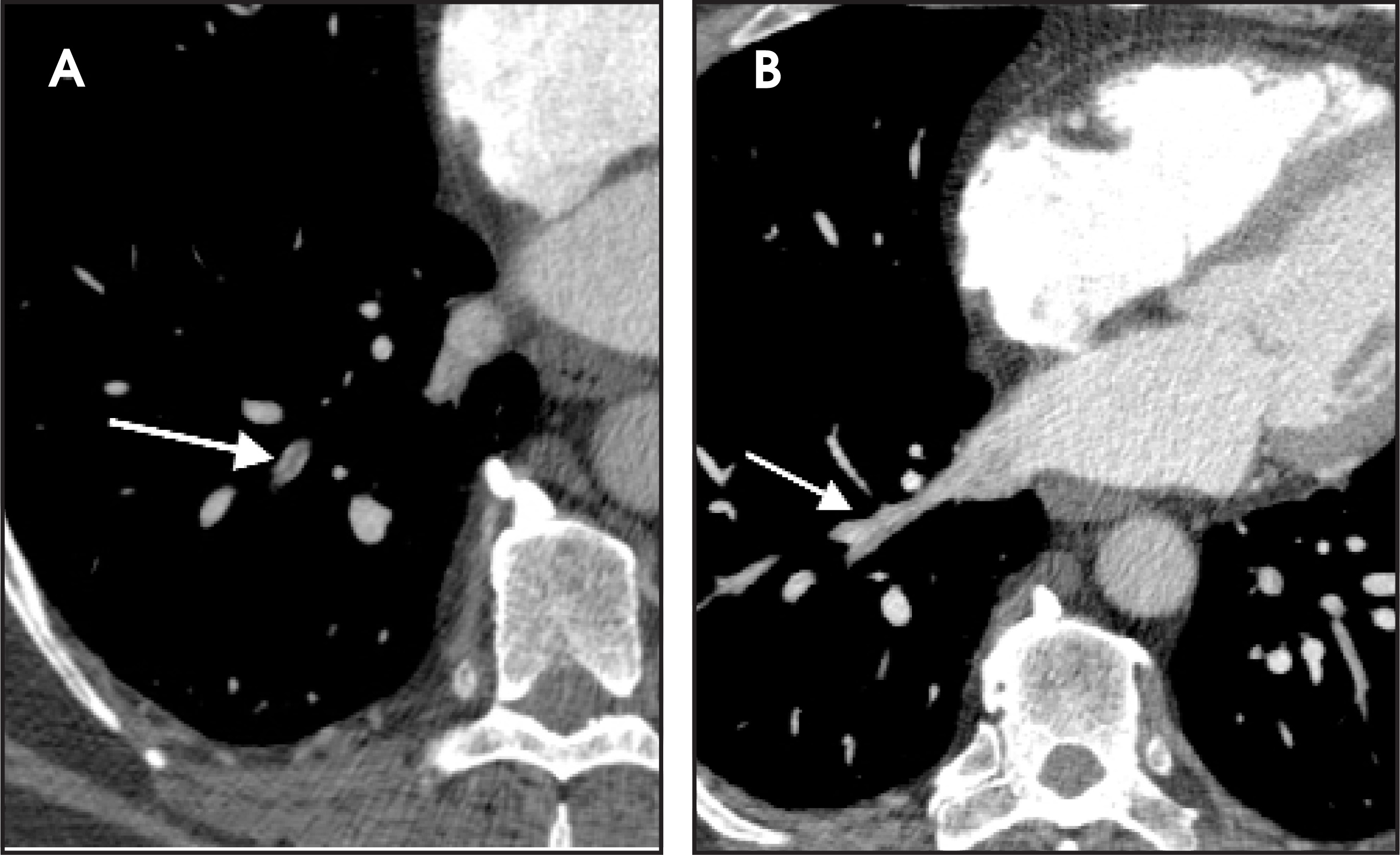 FIGURE 22.