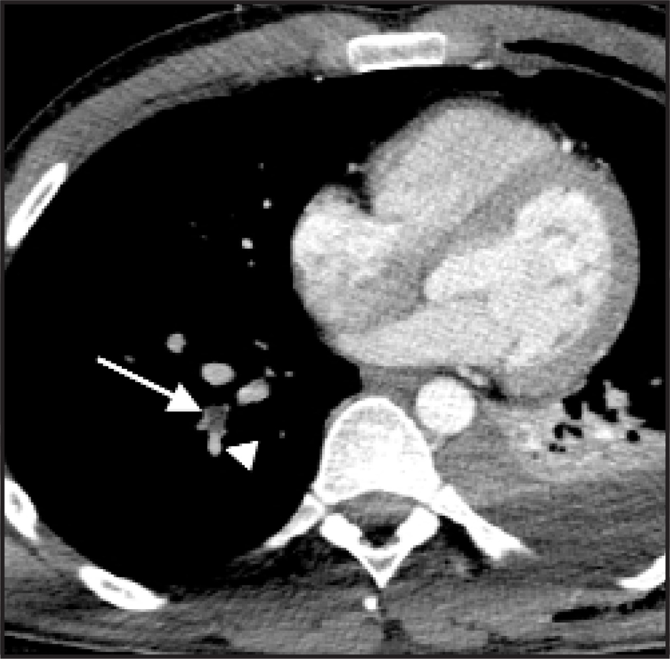 FIGURE 23.