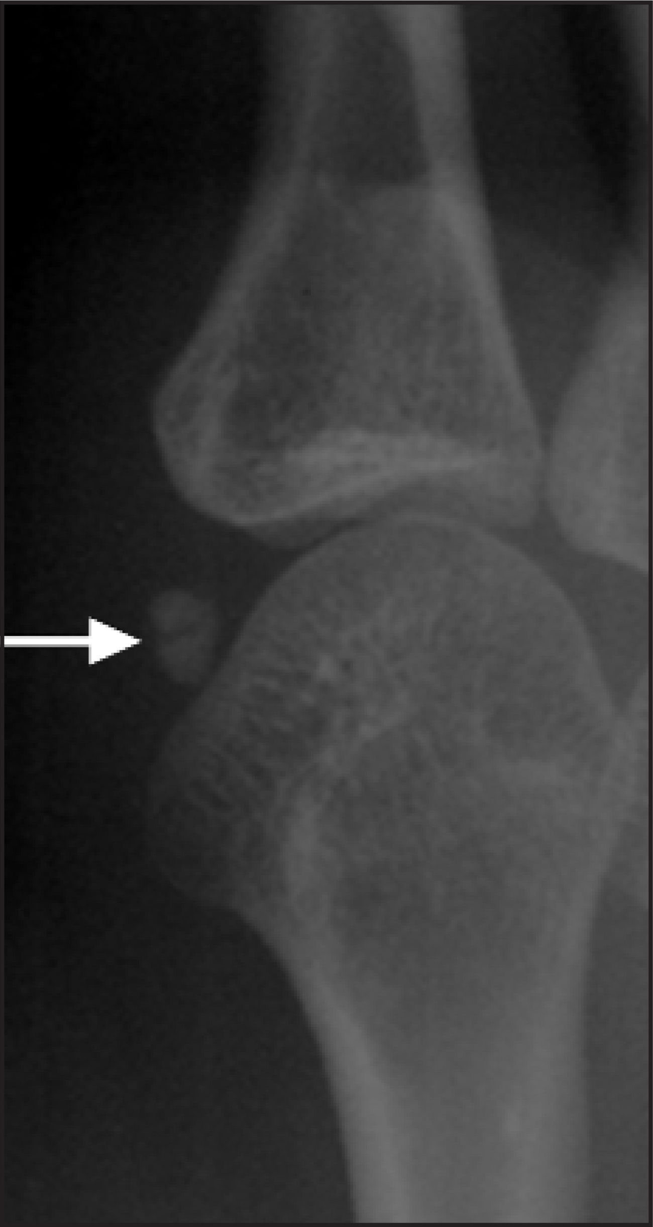 FIGURE 3.