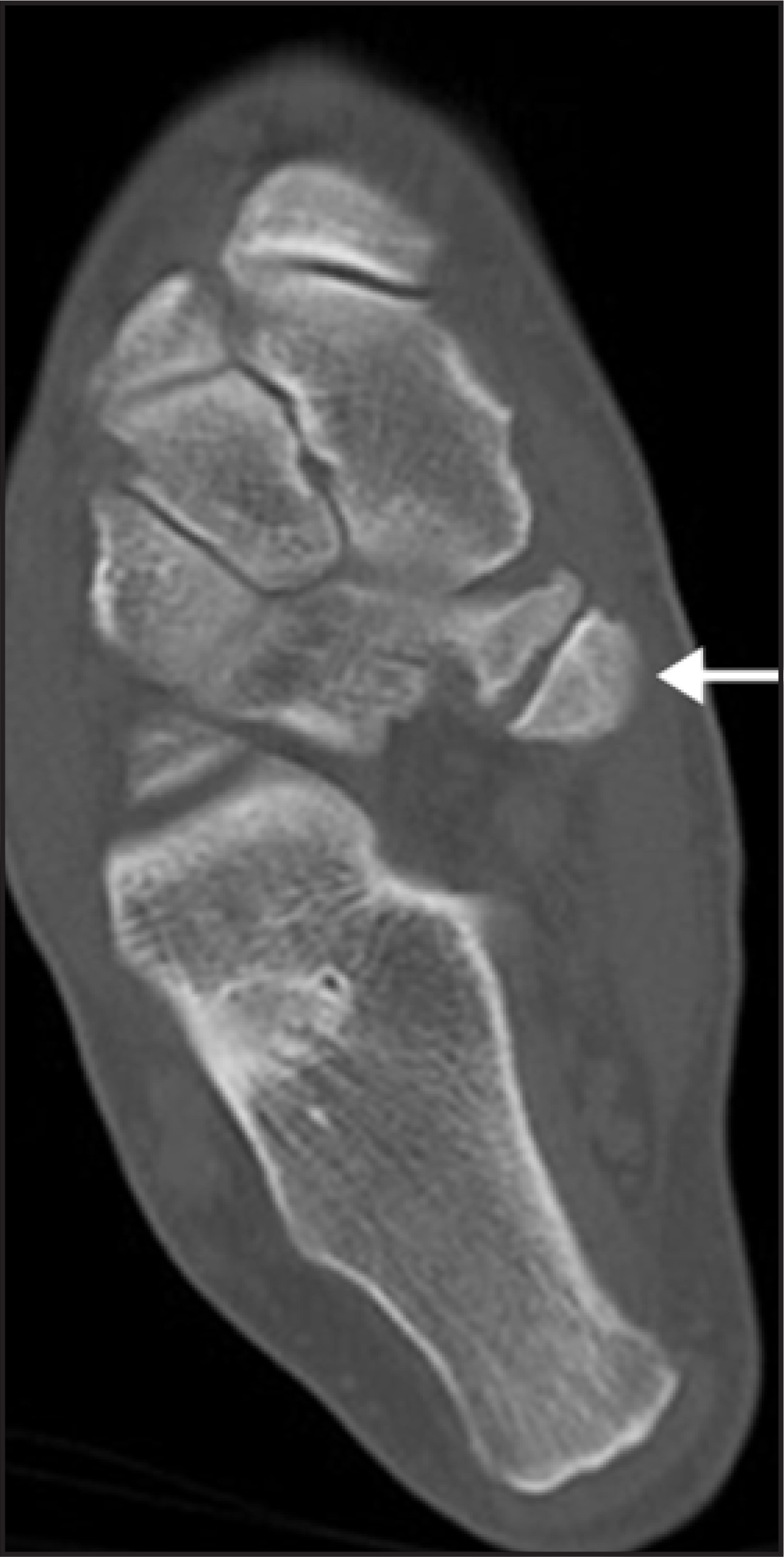 FIGURE 11.