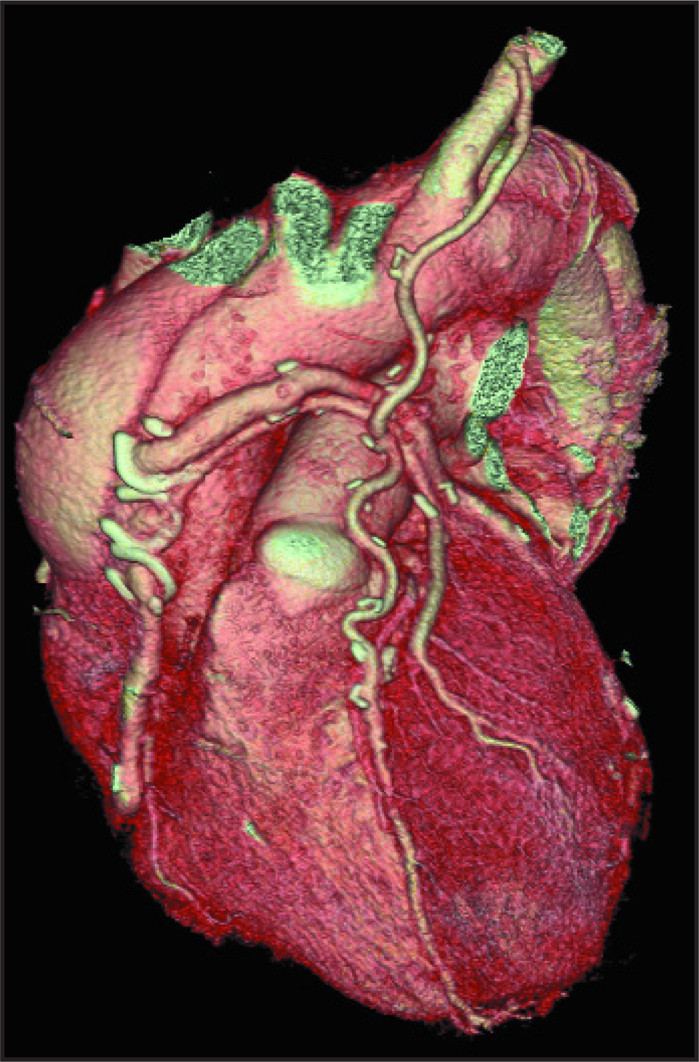 FIGURE 4.