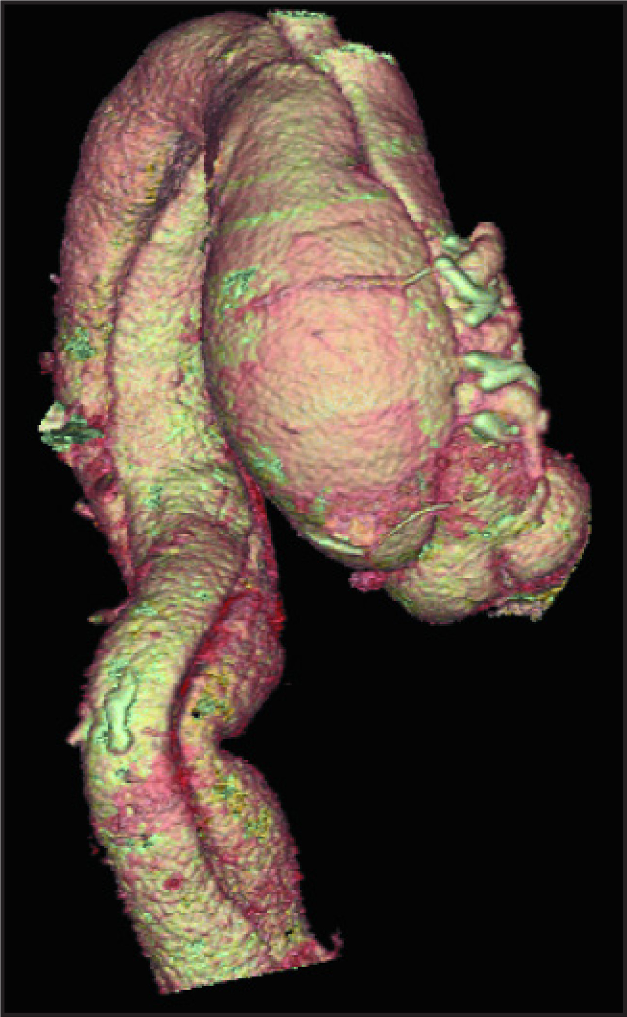 FIGURE 5.