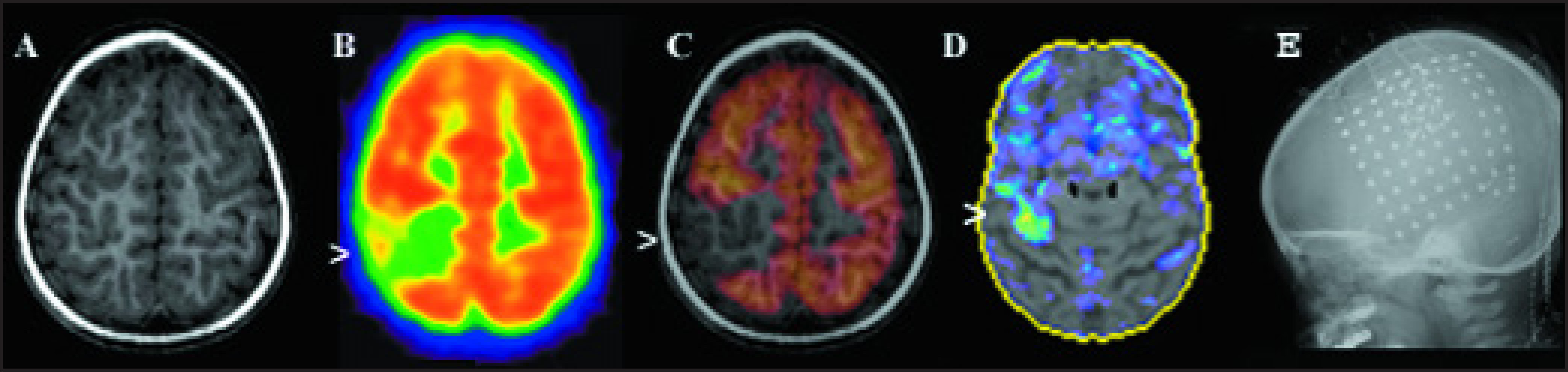 FIGURE 4.